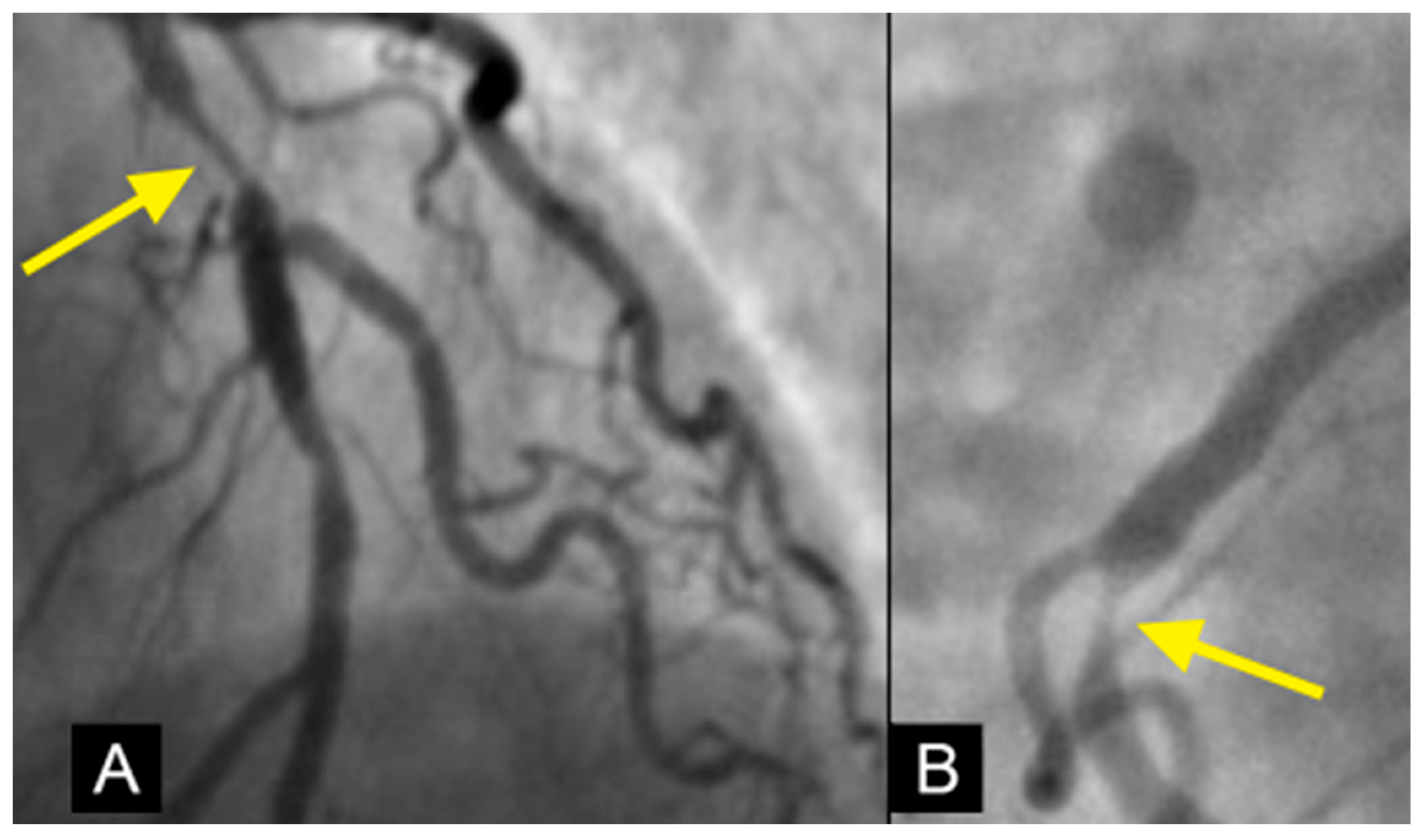 Diagnostics 15 00553 g022