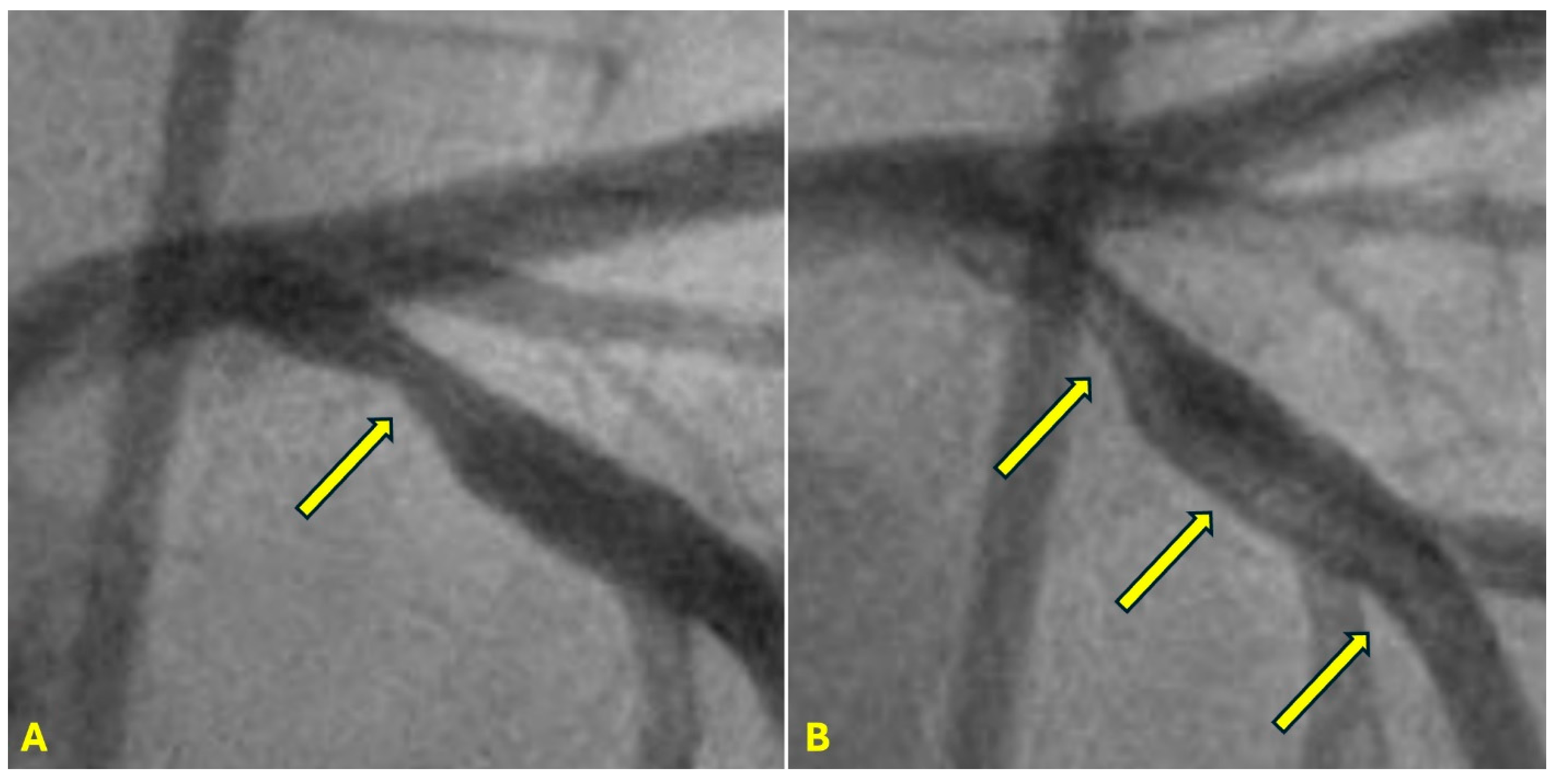 Diagnostics 15 00553 g023