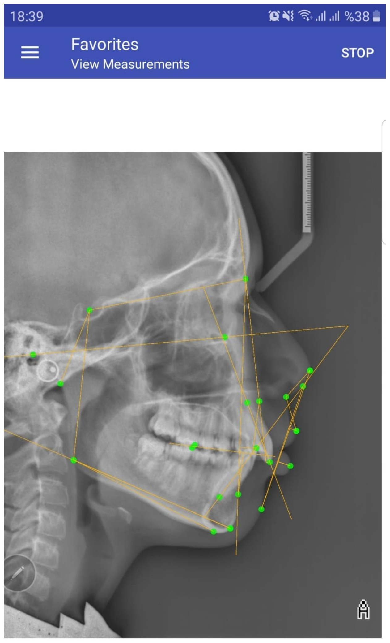 Diagnostics 15 00559 g003