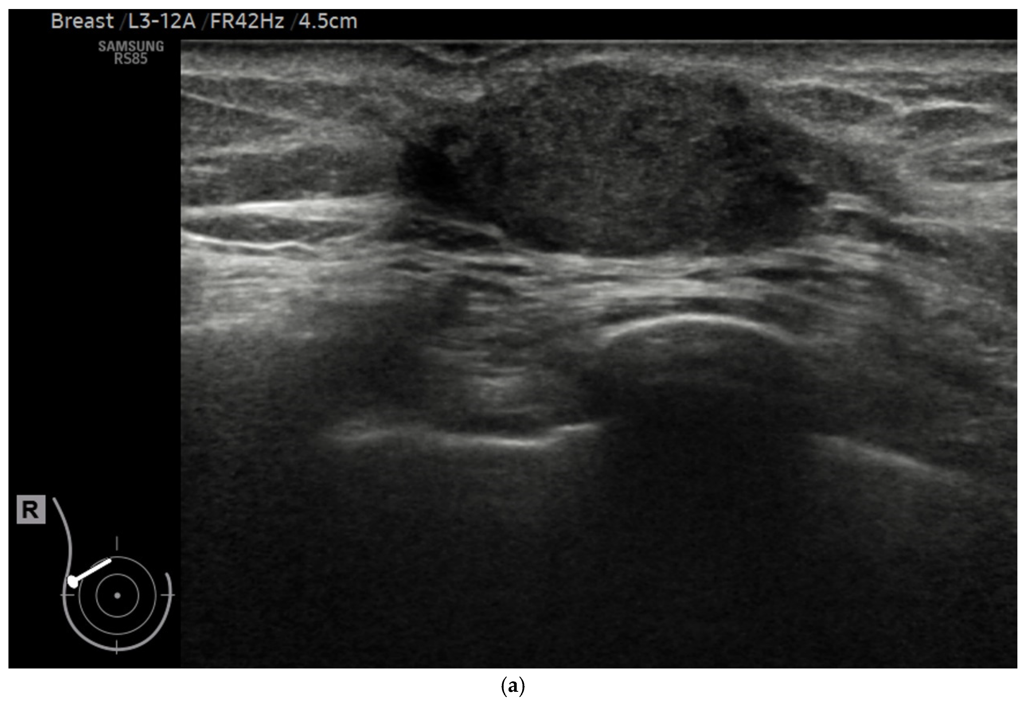 Diagnostics 15 00560 g002a Diagnostics 15 00560 g002a