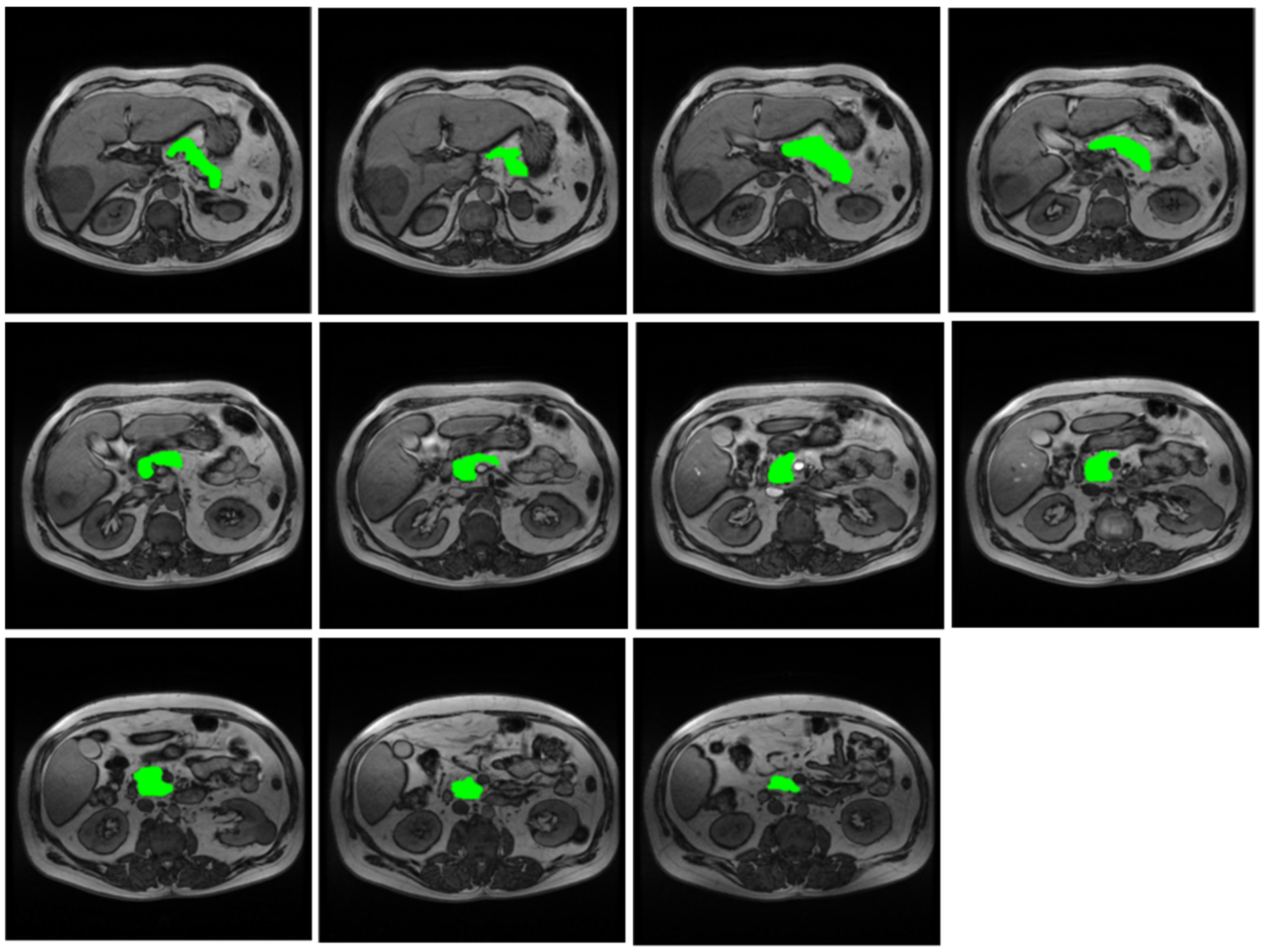 Diagnostics 15 00568 g001