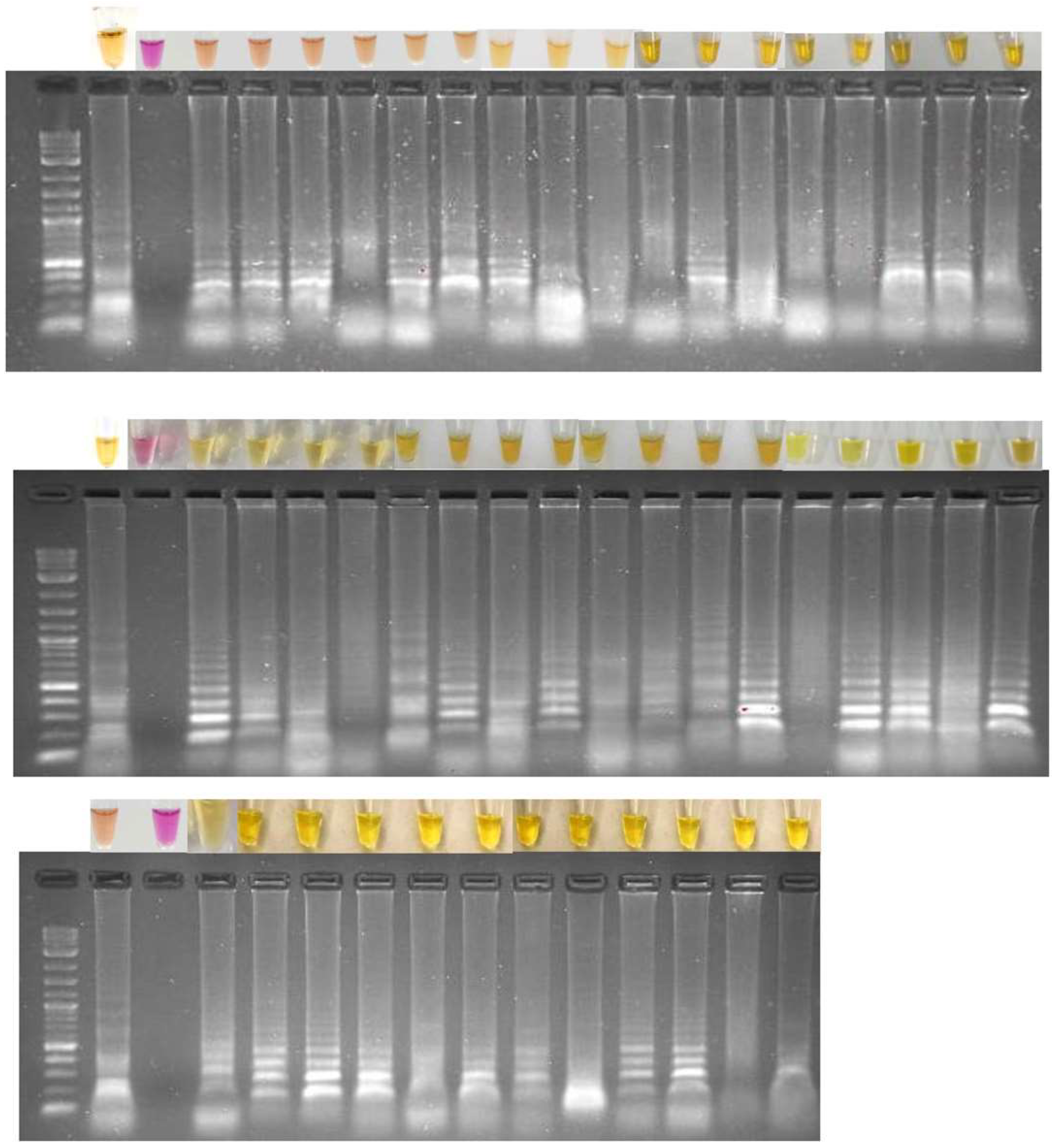 Diagnostics 15 00570 g004