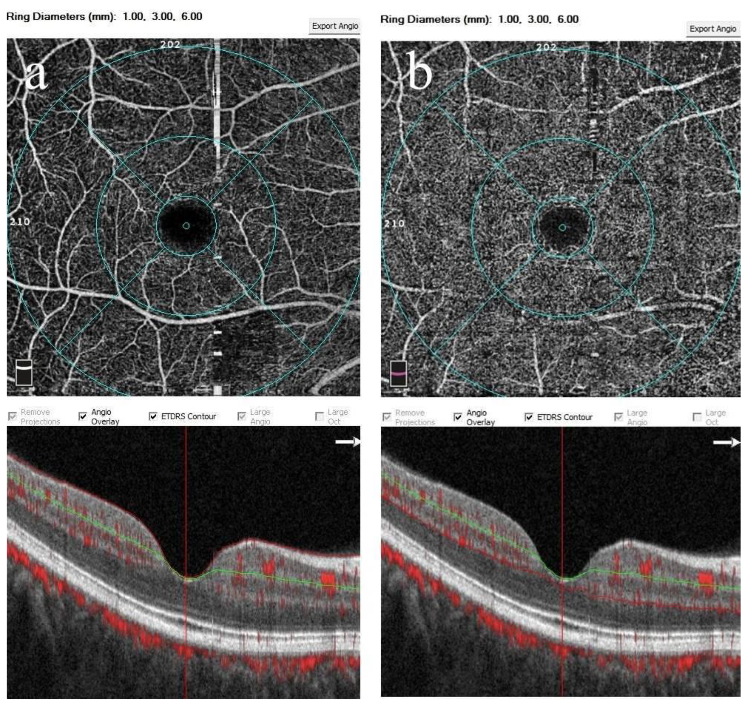 Diagnostics 15 00572 g002 Diagnostics 15 00572 g002