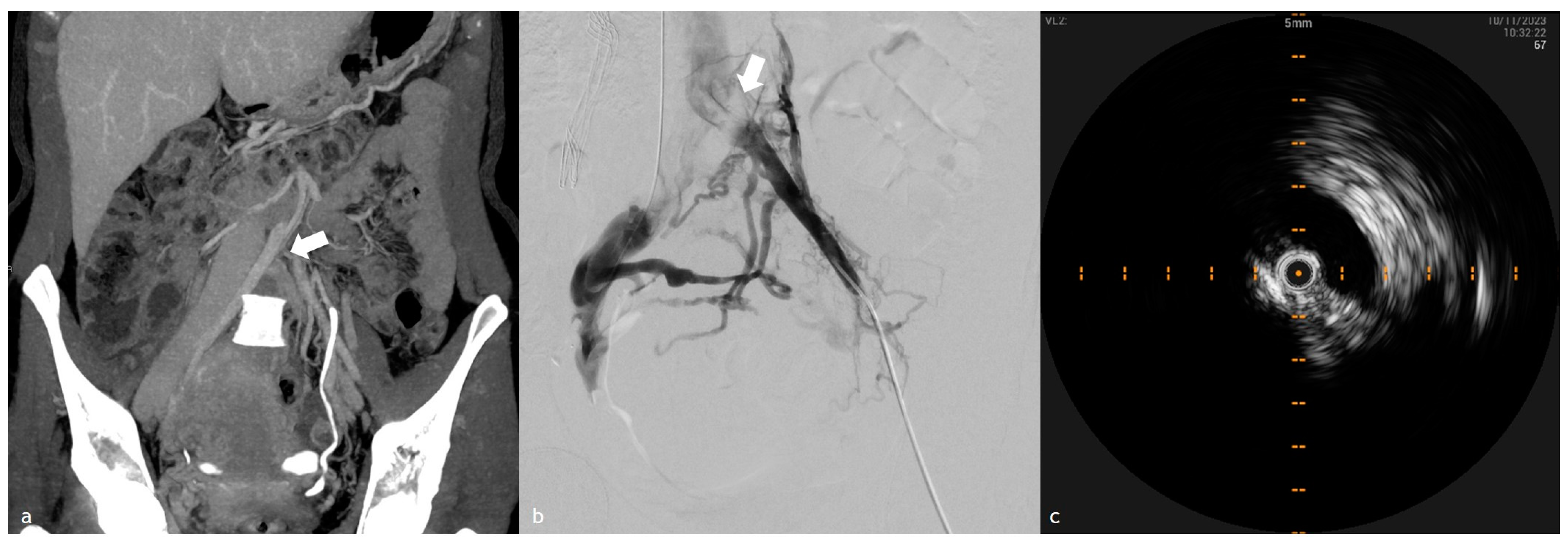 Diagnostics 15 00577 g003