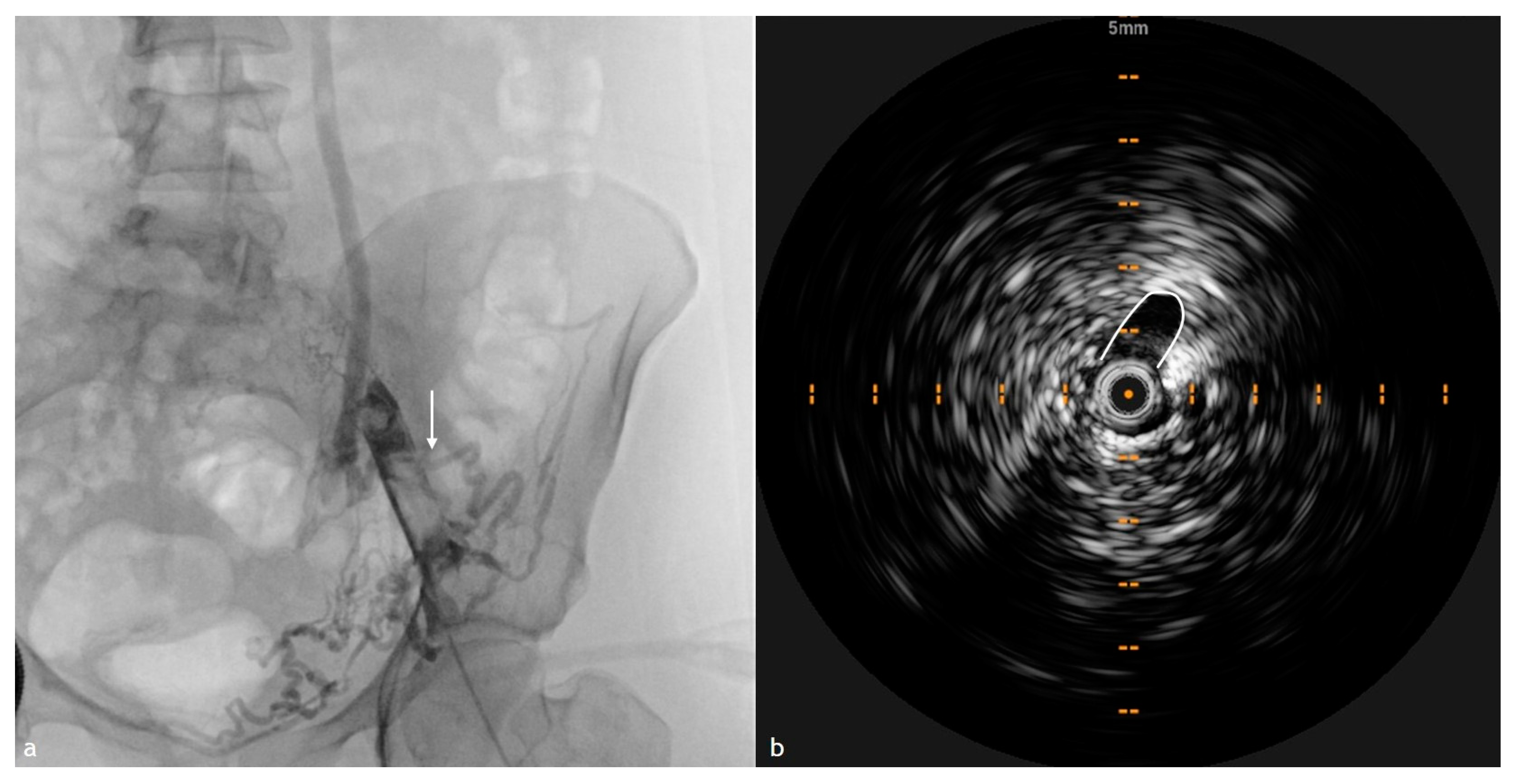 Diagnostics 15 00577 g005