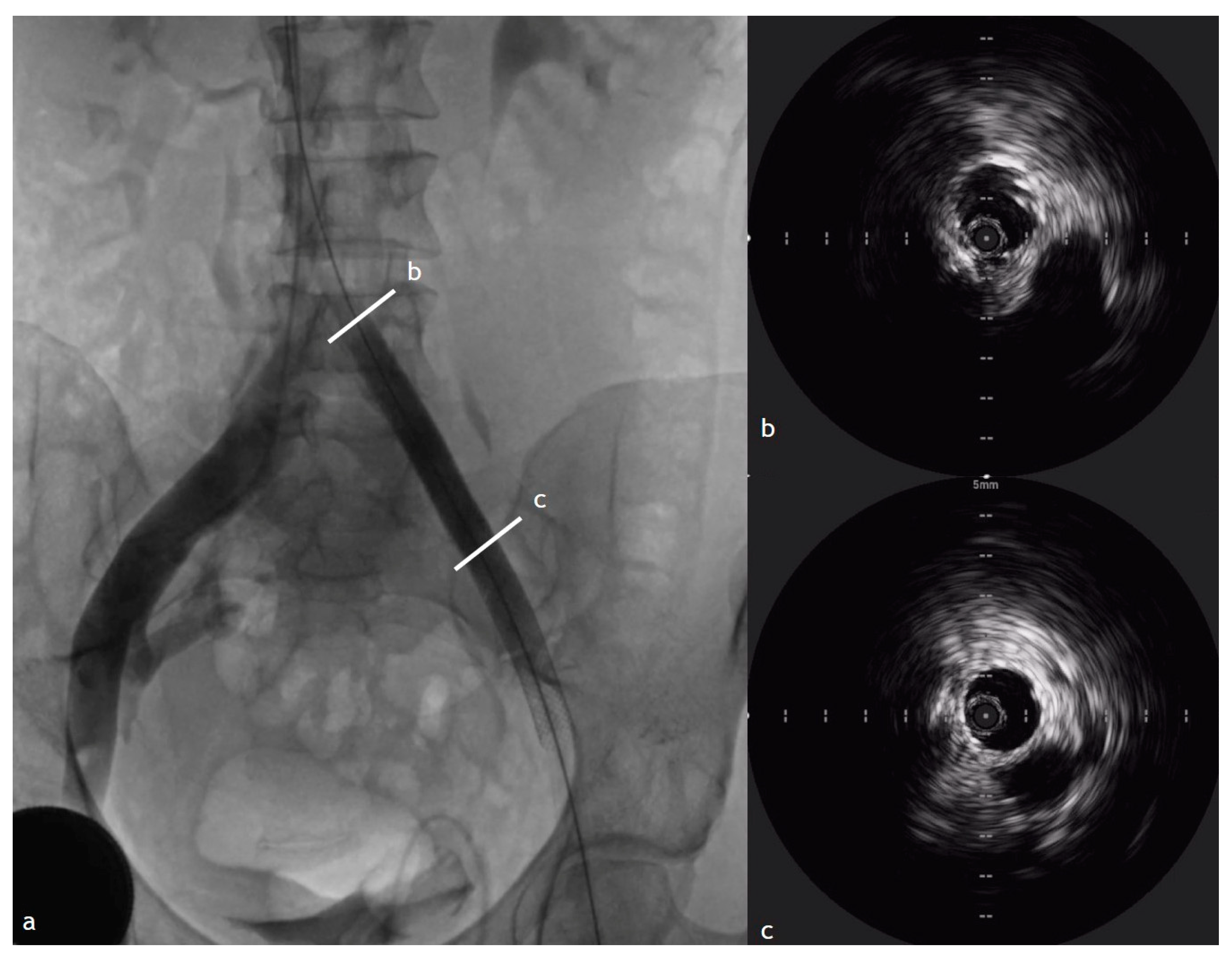 Diagnostics 15 00577 g006
