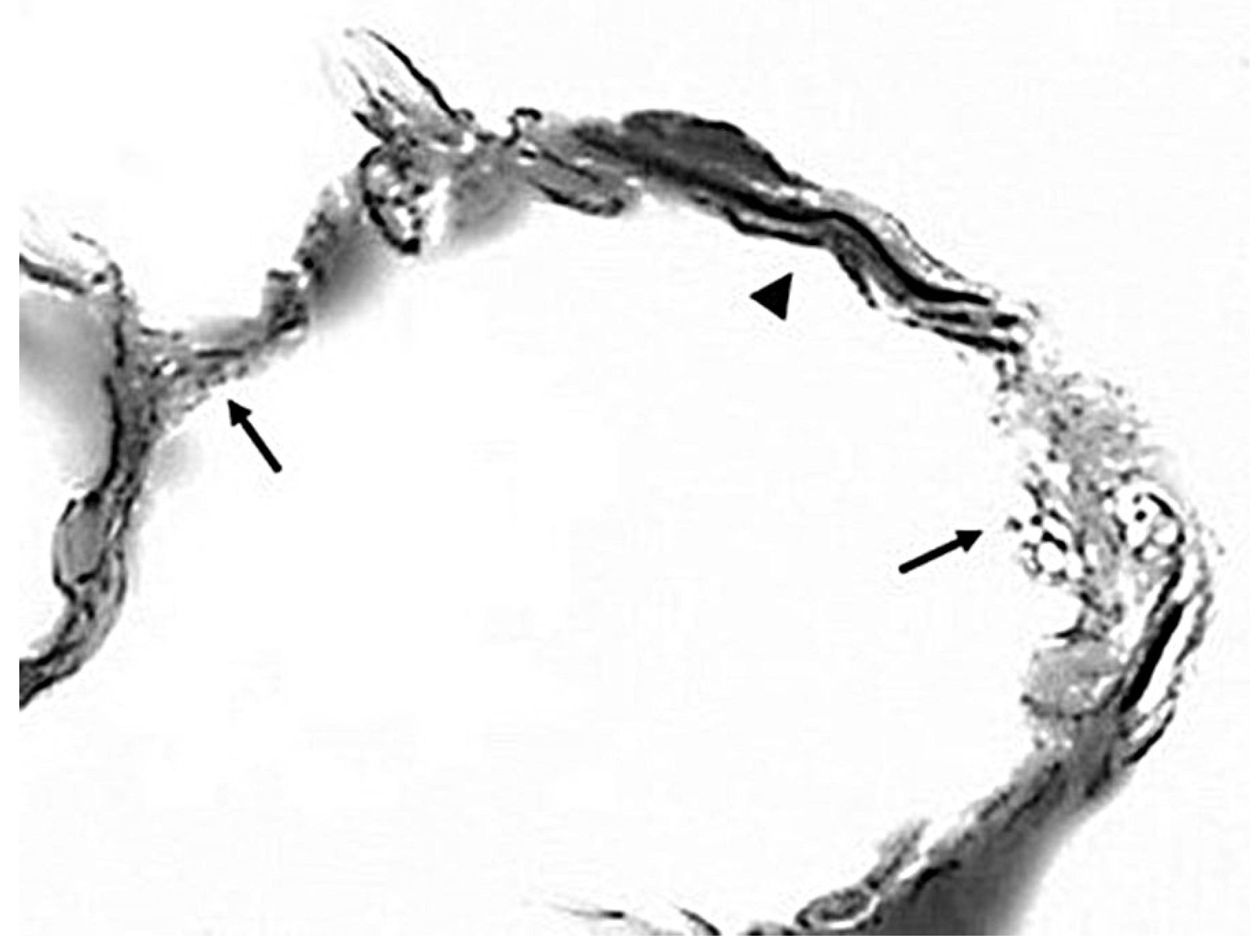 Diagnostics 15 00578 g003