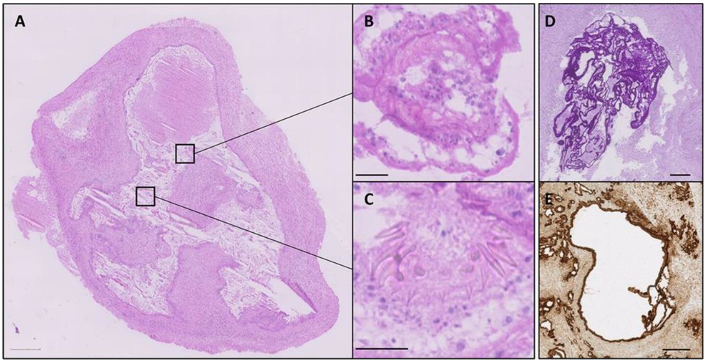 Diagnostics 15 00585 g003