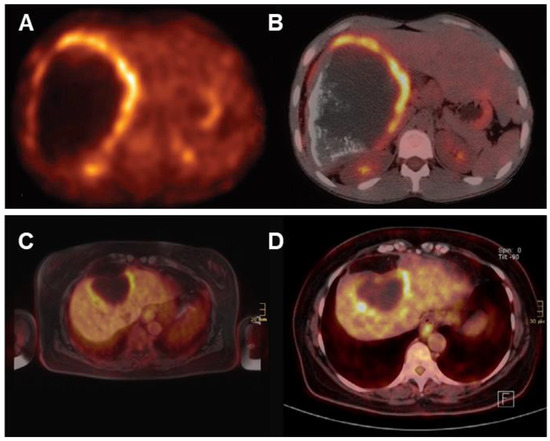 Advances in Novel Diagnostic Techniques for Alveolar