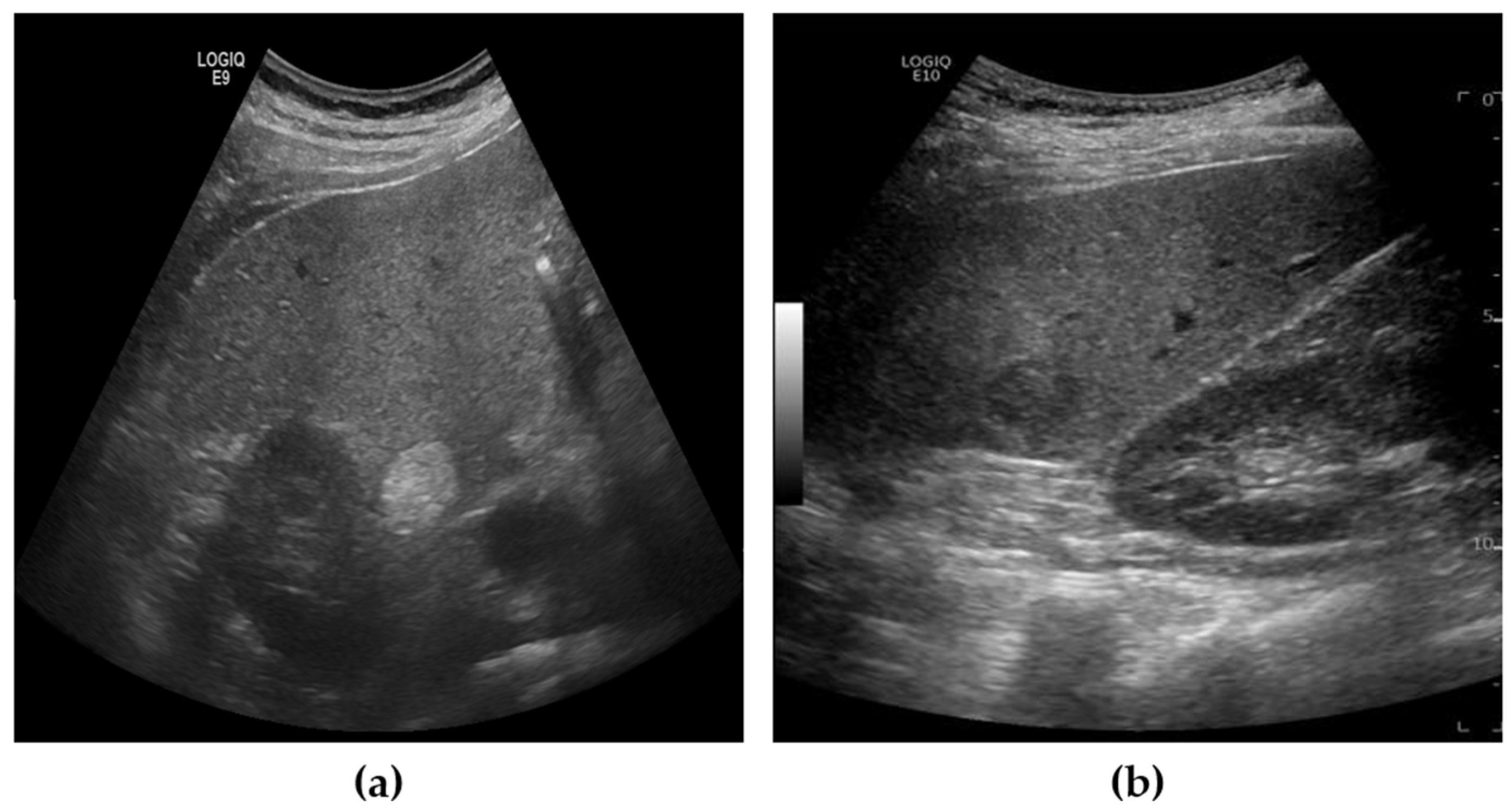 Diagnostics 15 00588 g001