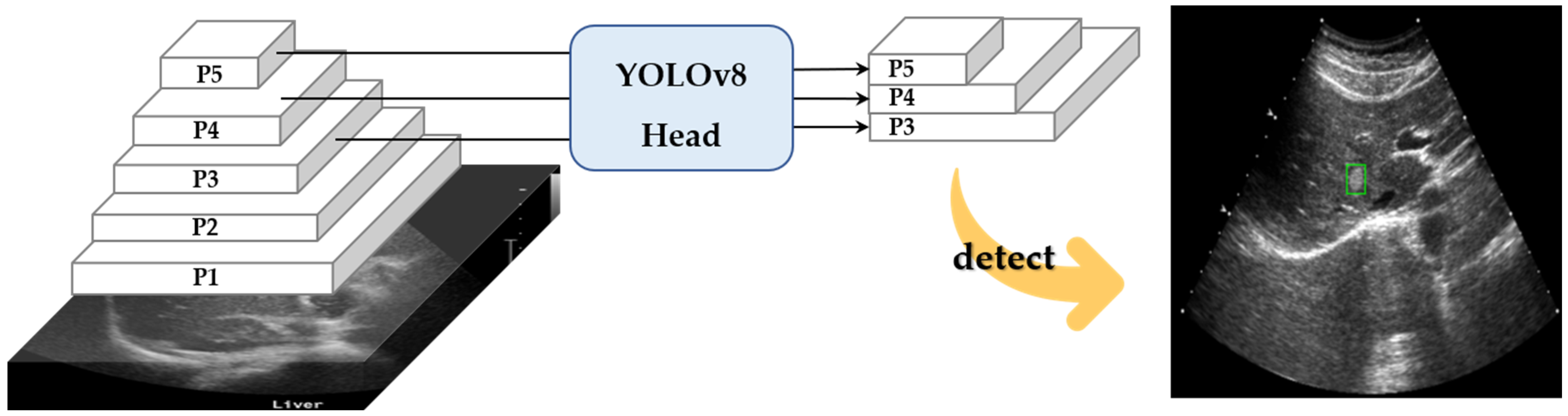 Diagnostics 15 00588 g004