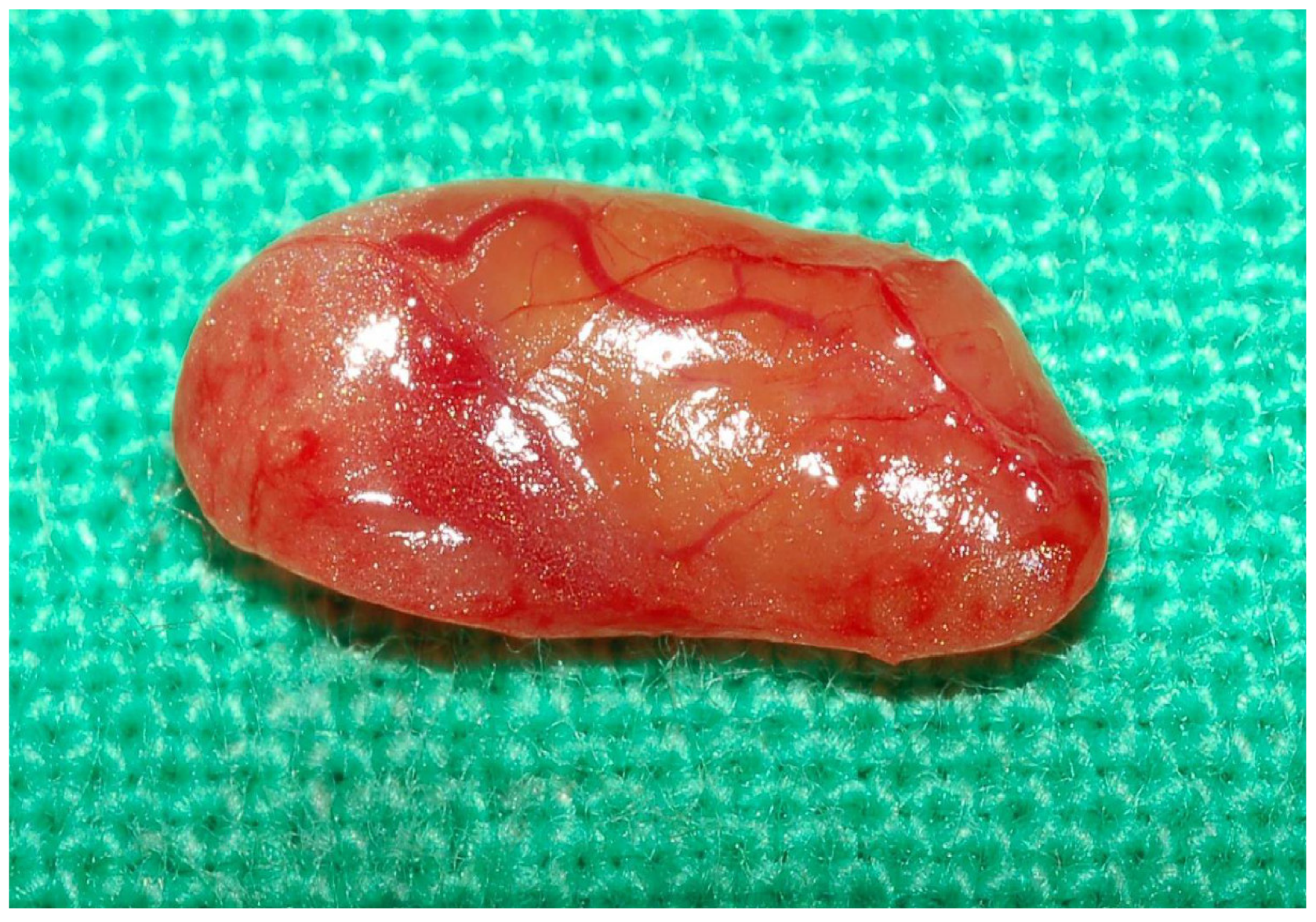 Diagnostics 15 00593 g003 Diagnostics 15 00593 g003