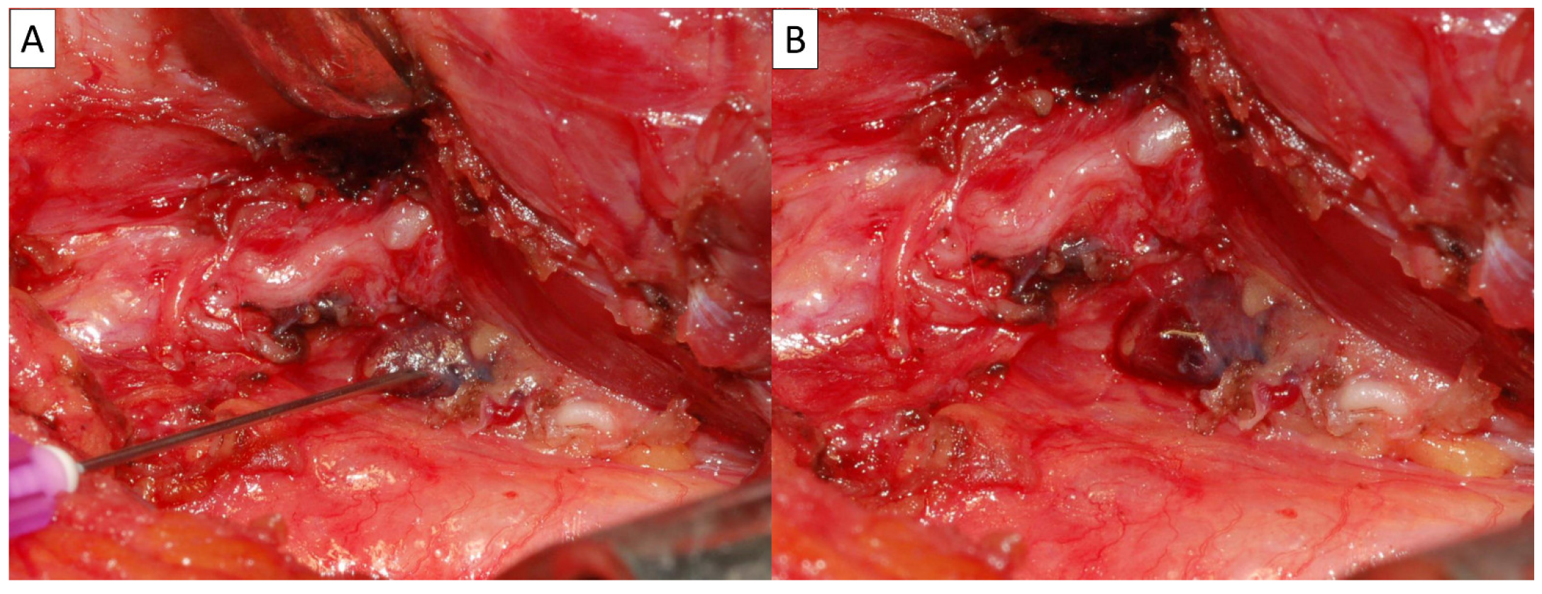 Diagnostics 15 00593 g004 Diagnostics 15 00593 g004