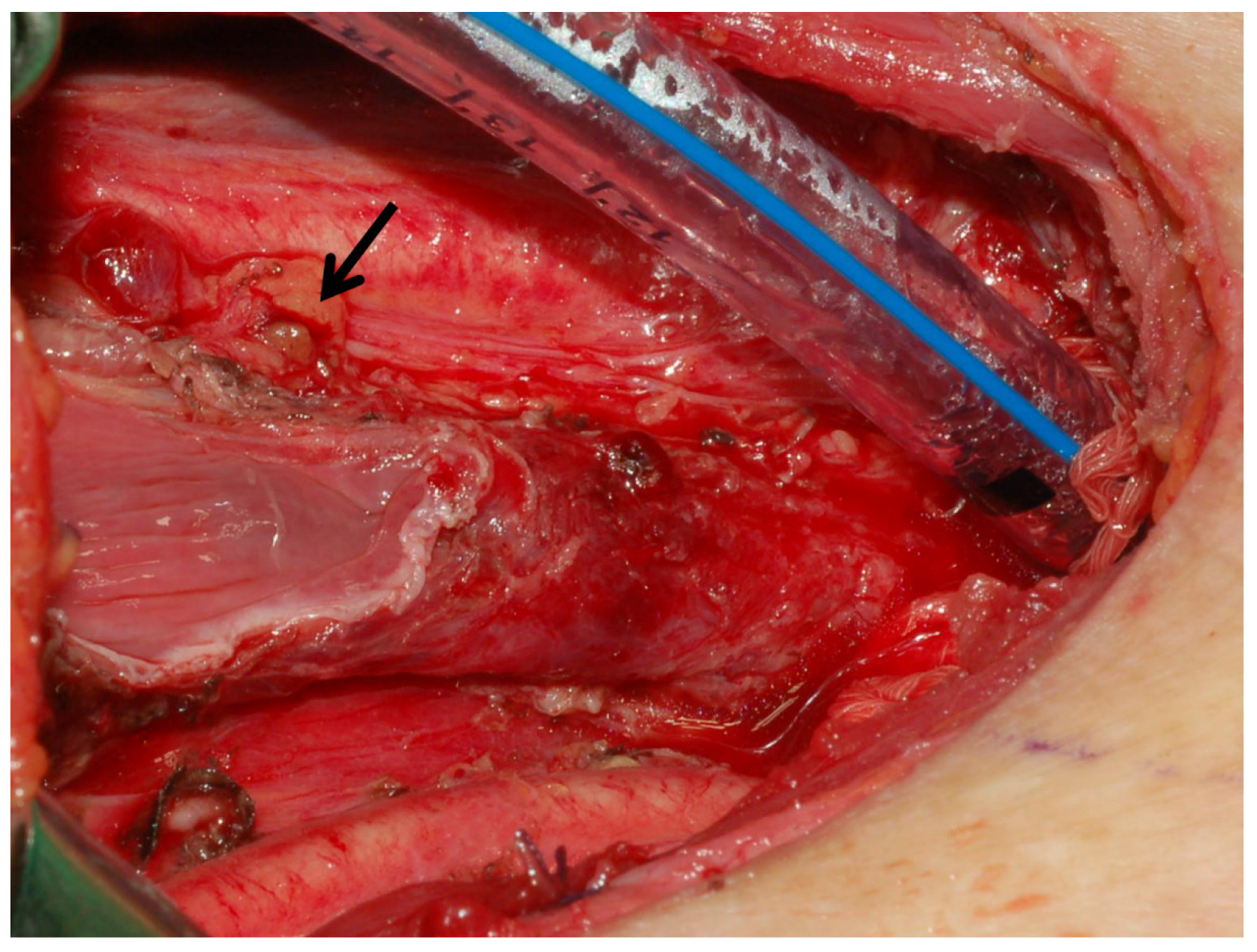 Diagnostics 15 00593 g005 Diagnostics 15 00593 g005