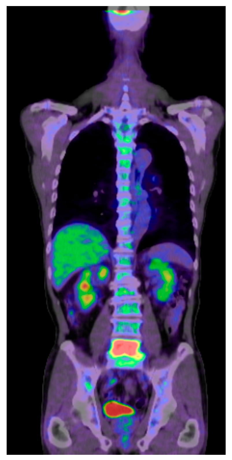 Diagnostics 15 00594 g004