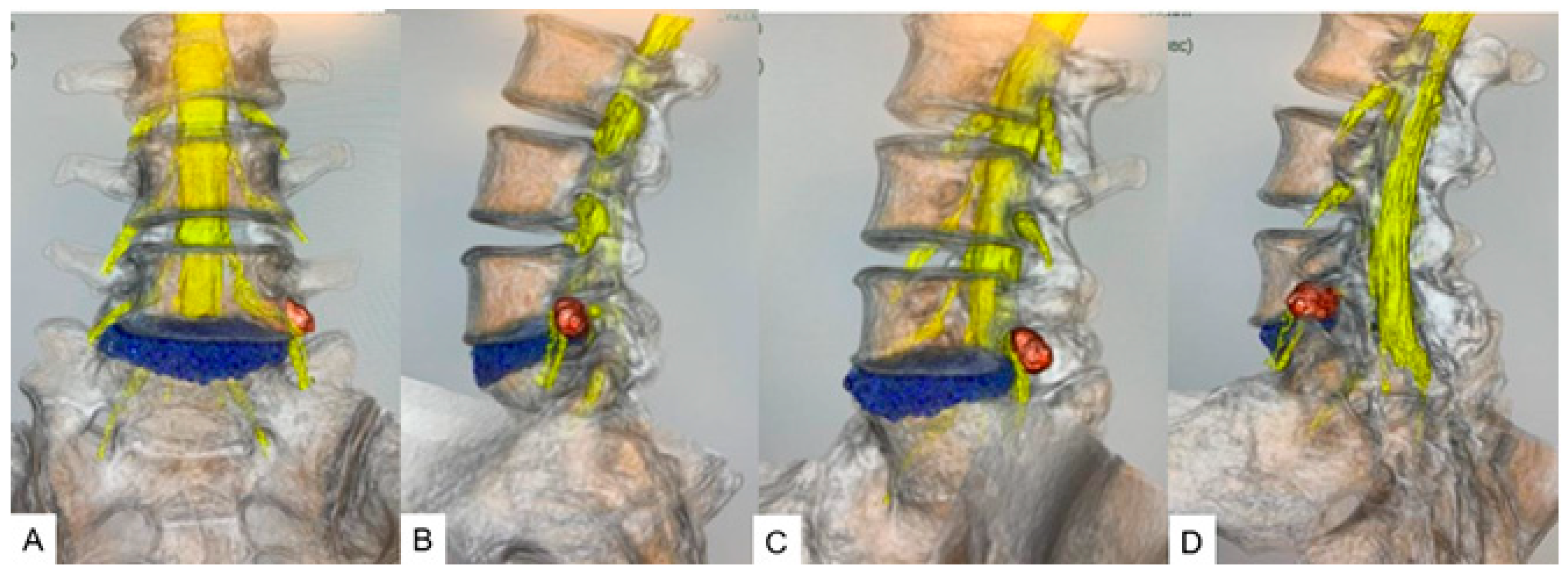 Diagnostics 15 00594 g005