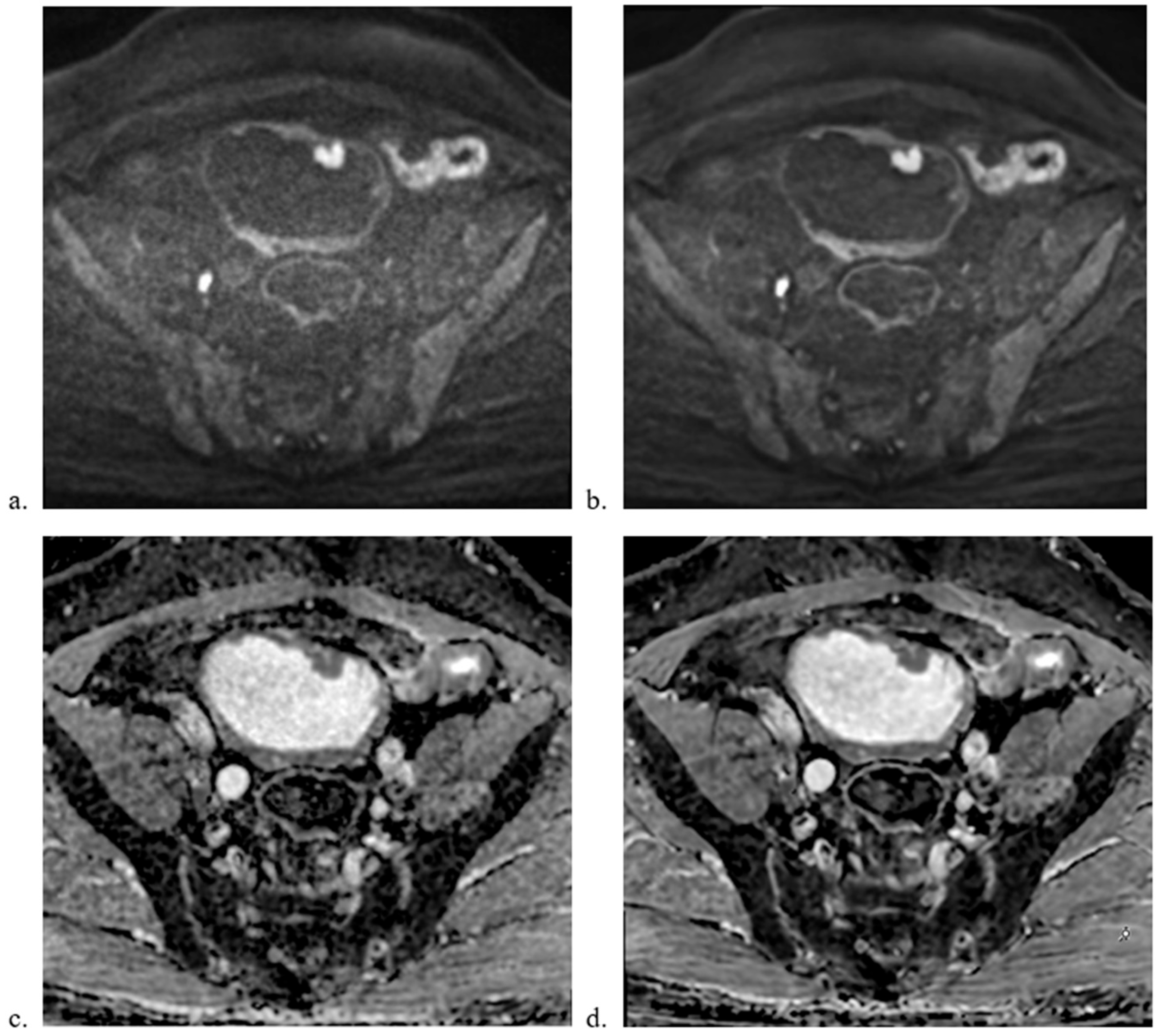 Diagnostics 15 00595 g002