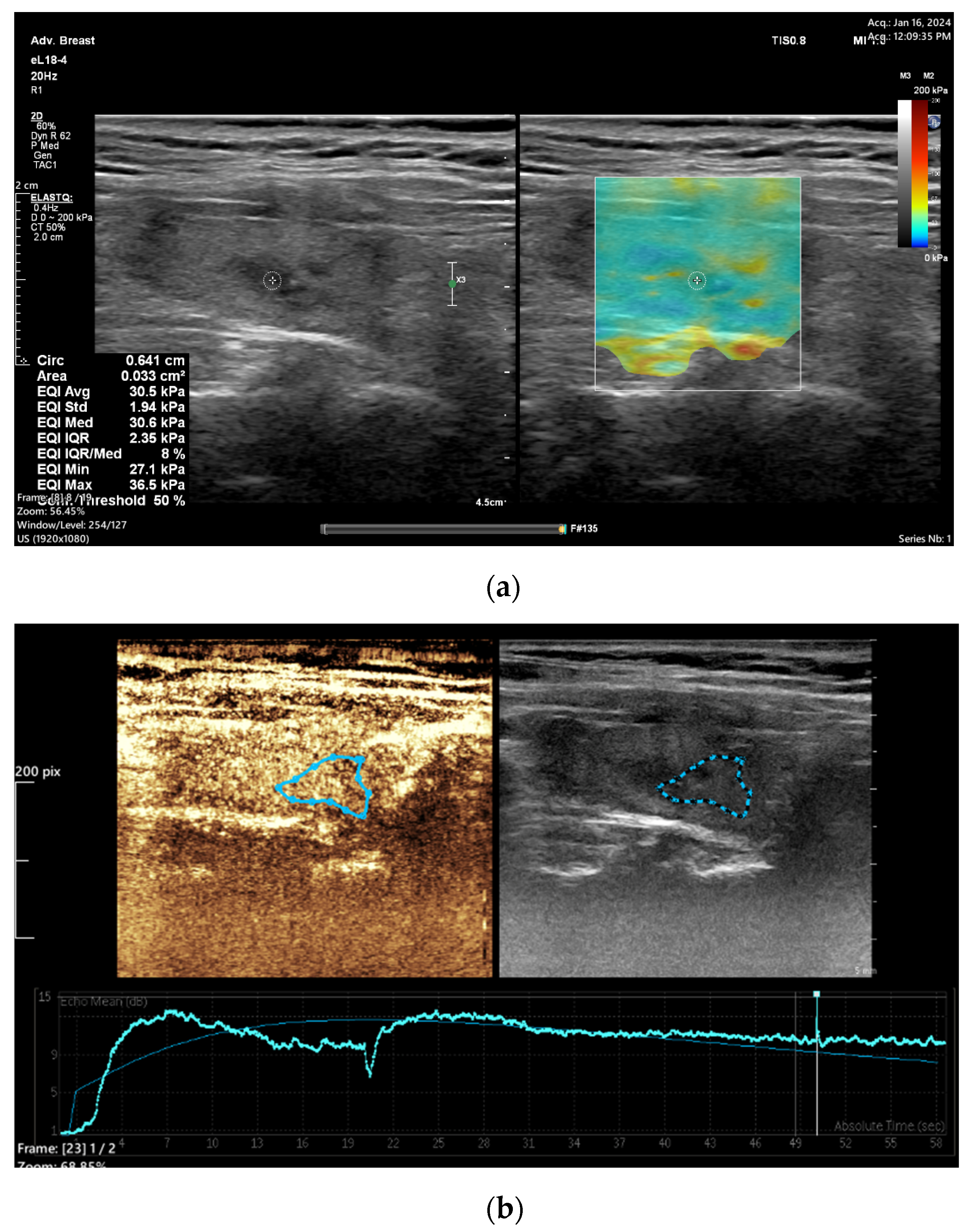 Diagnostics 15 00599 g001 Diagnostics 15 00599 g001
