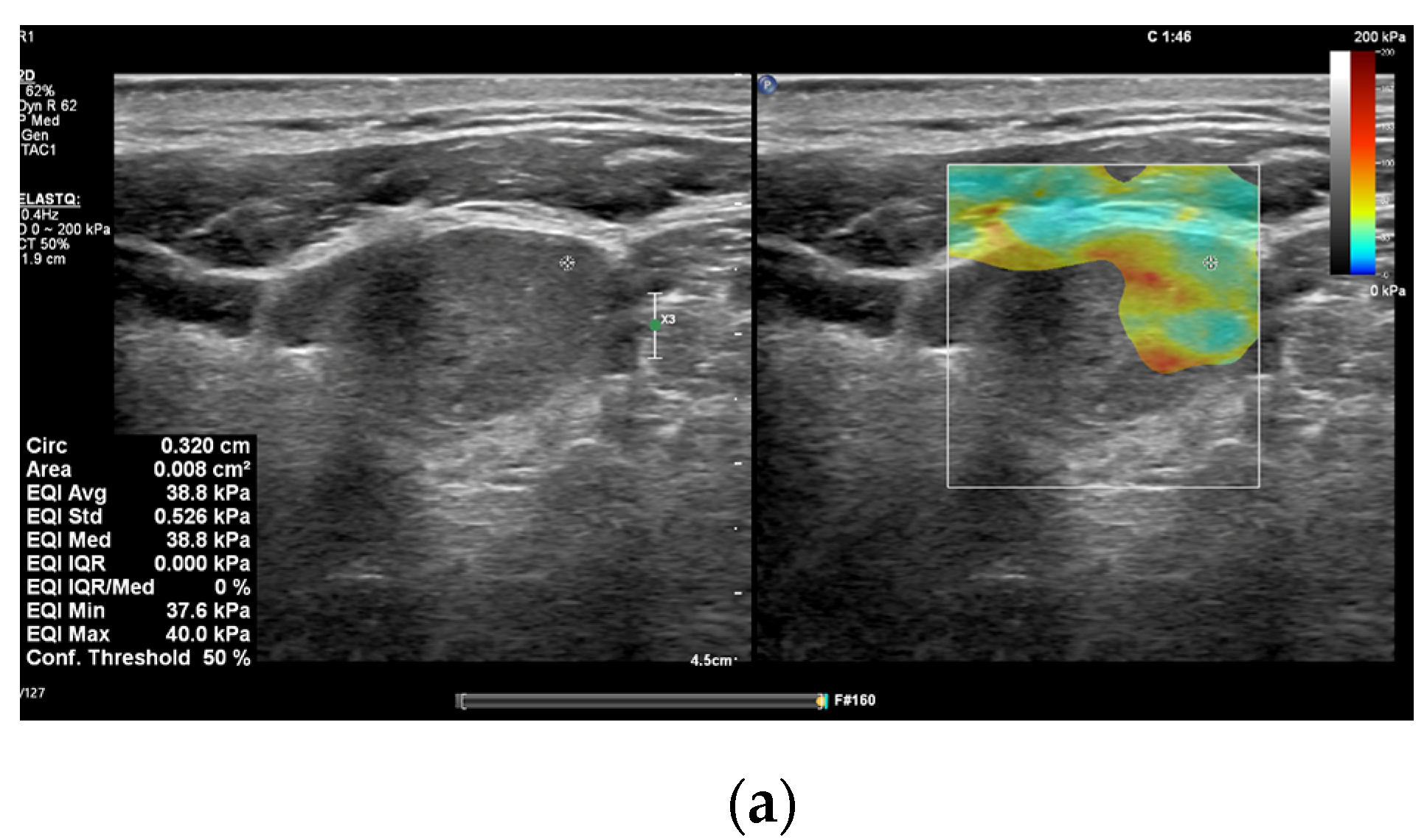 Diagnostics 15 00599 g002a Diagnostics 15 00599 g002a