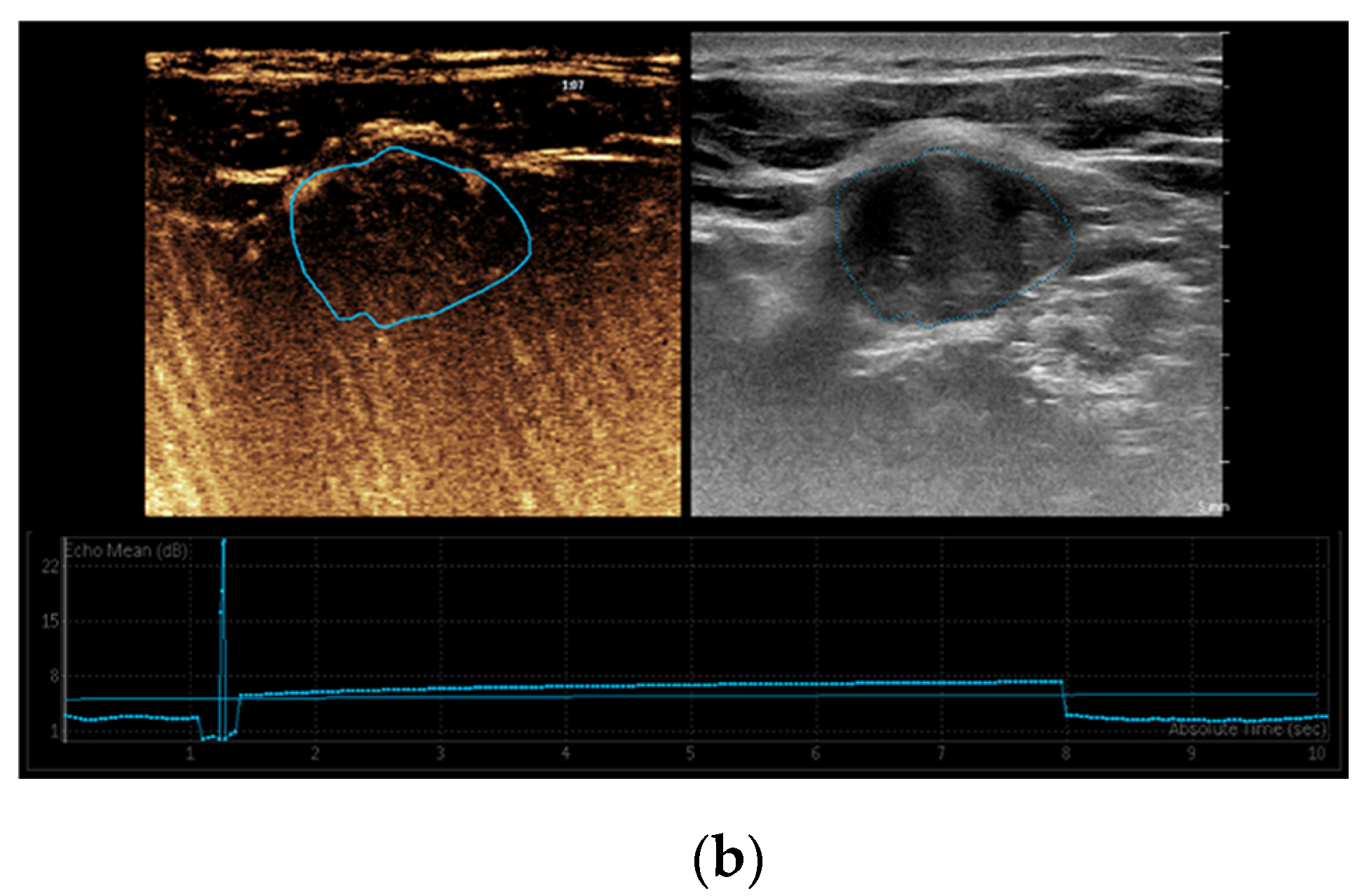 Diagnostics 15 00599 g002b Diagnostics 15 00599 g002b