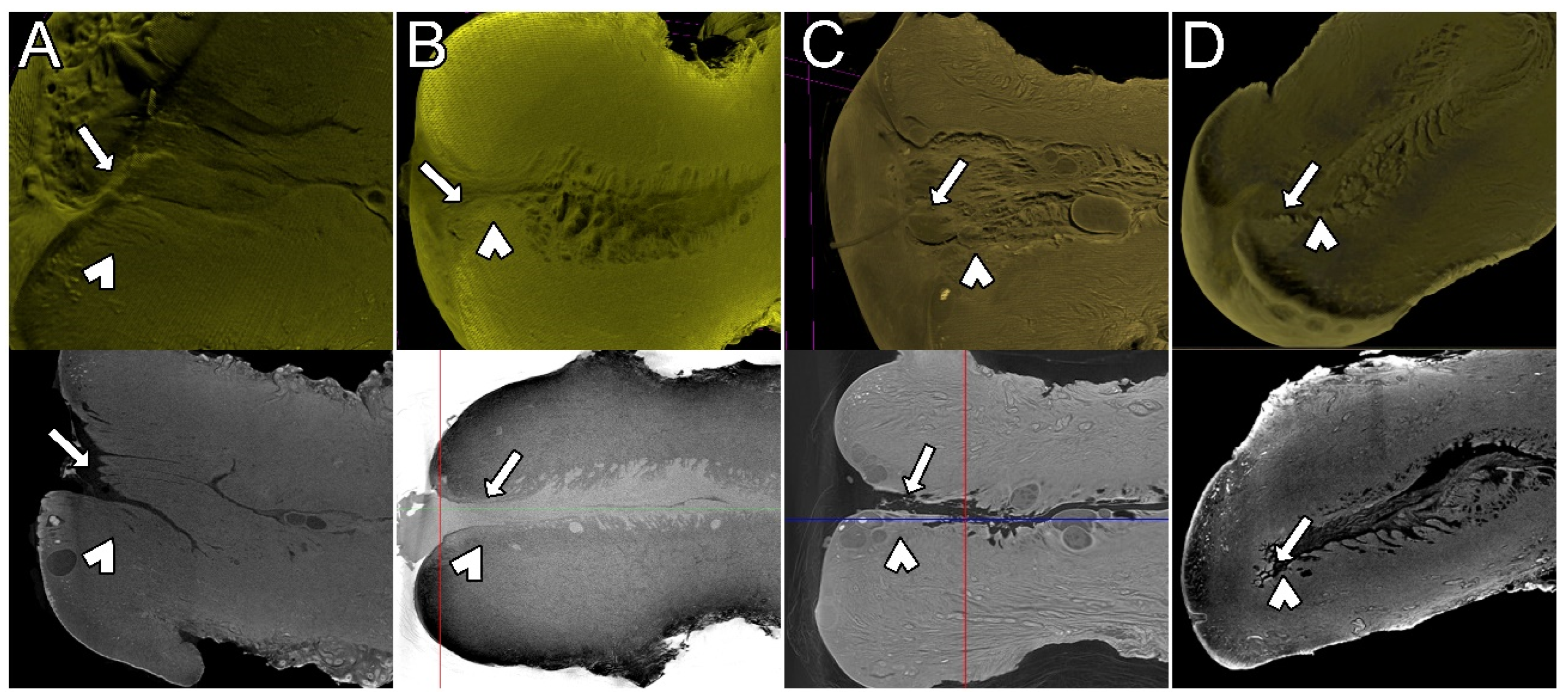 Diagnostics 15 00603 g005
