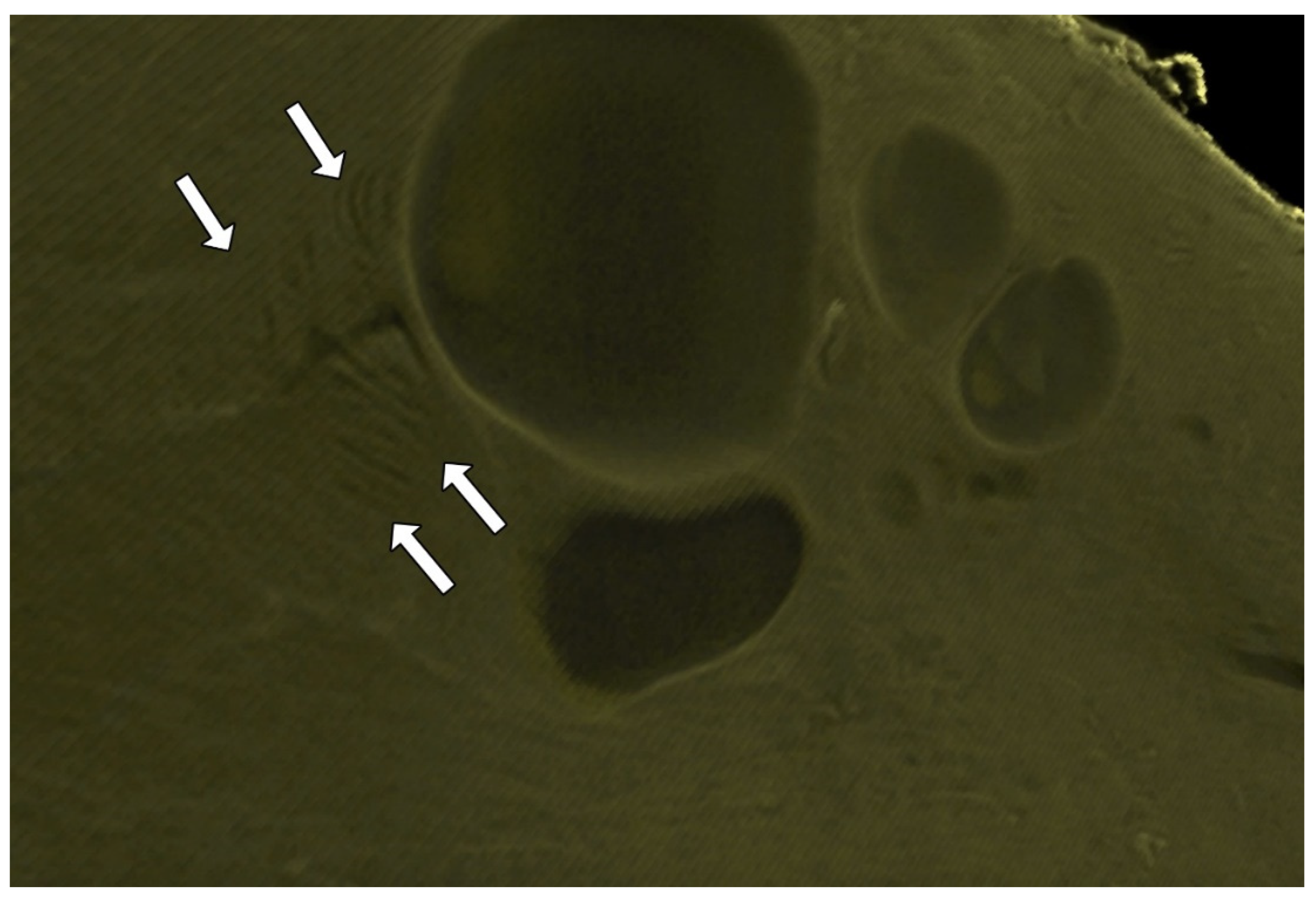 Diagnostics 15 00603 g006