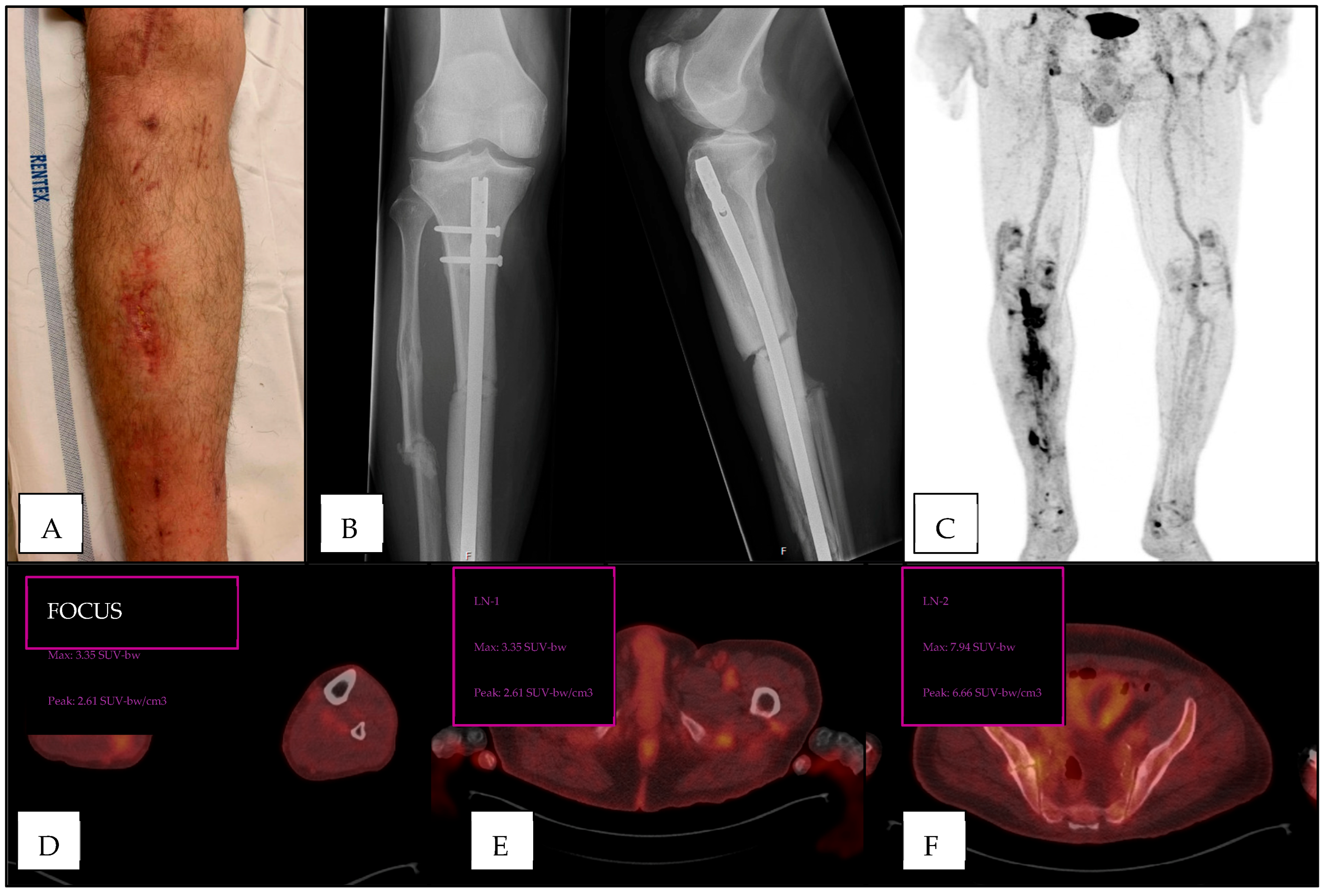 Diagnostics 15 00616 g003