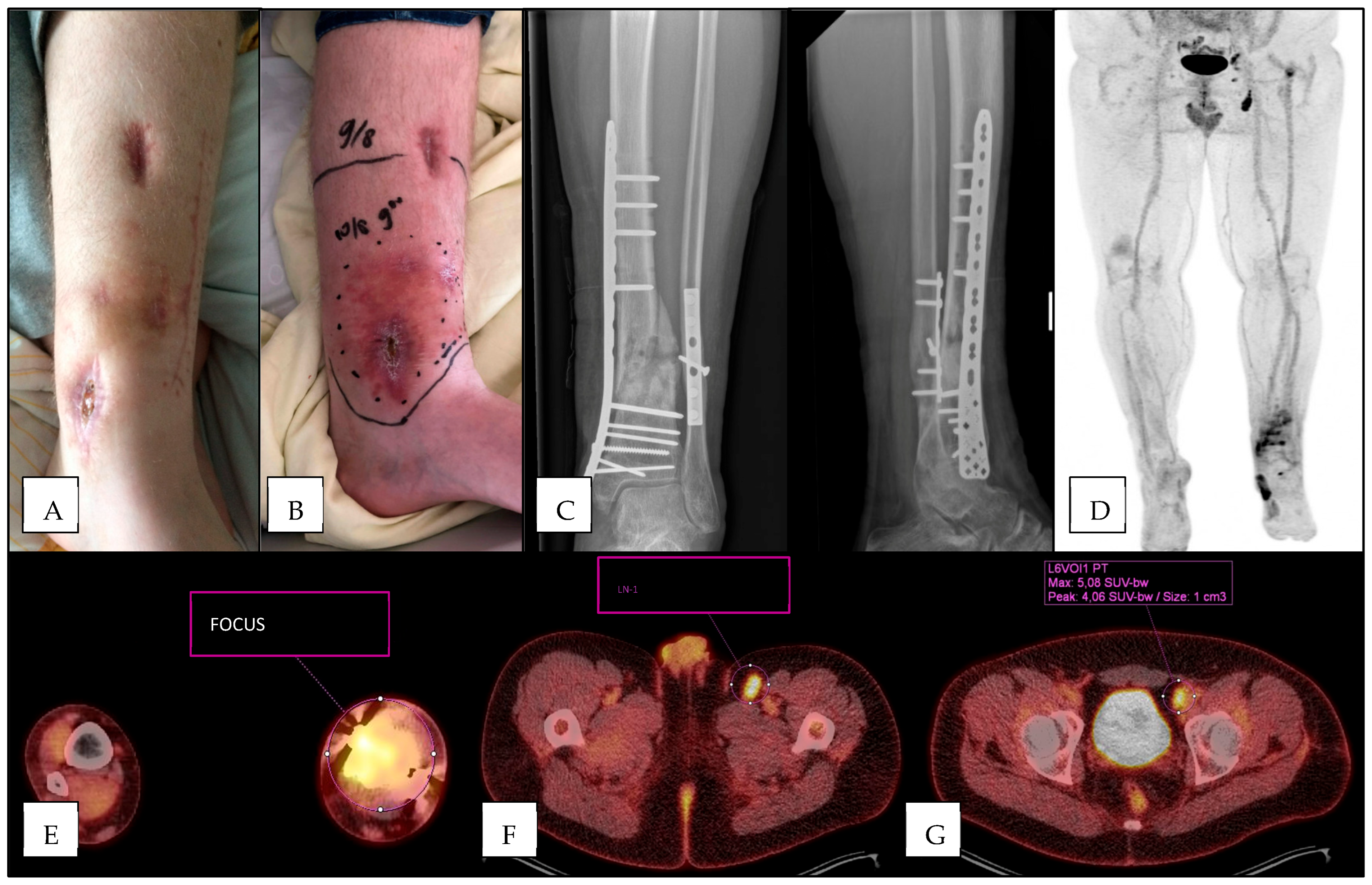 Diagnostics 15 00616 g004