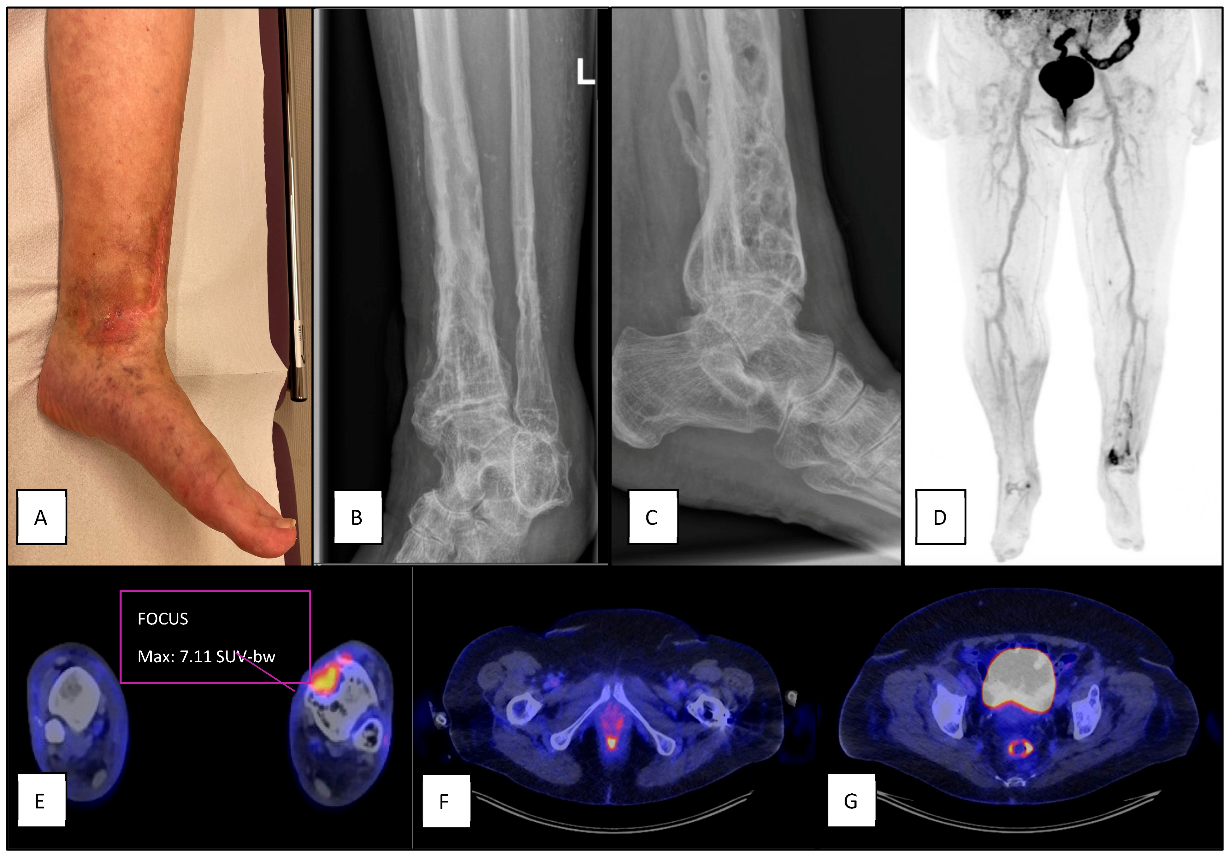 Diagnostics 15 00616 g005