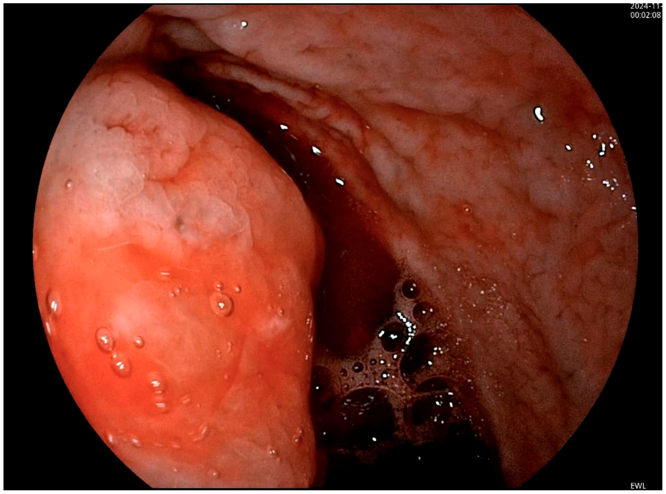 Diagnostics 15 00617 g001