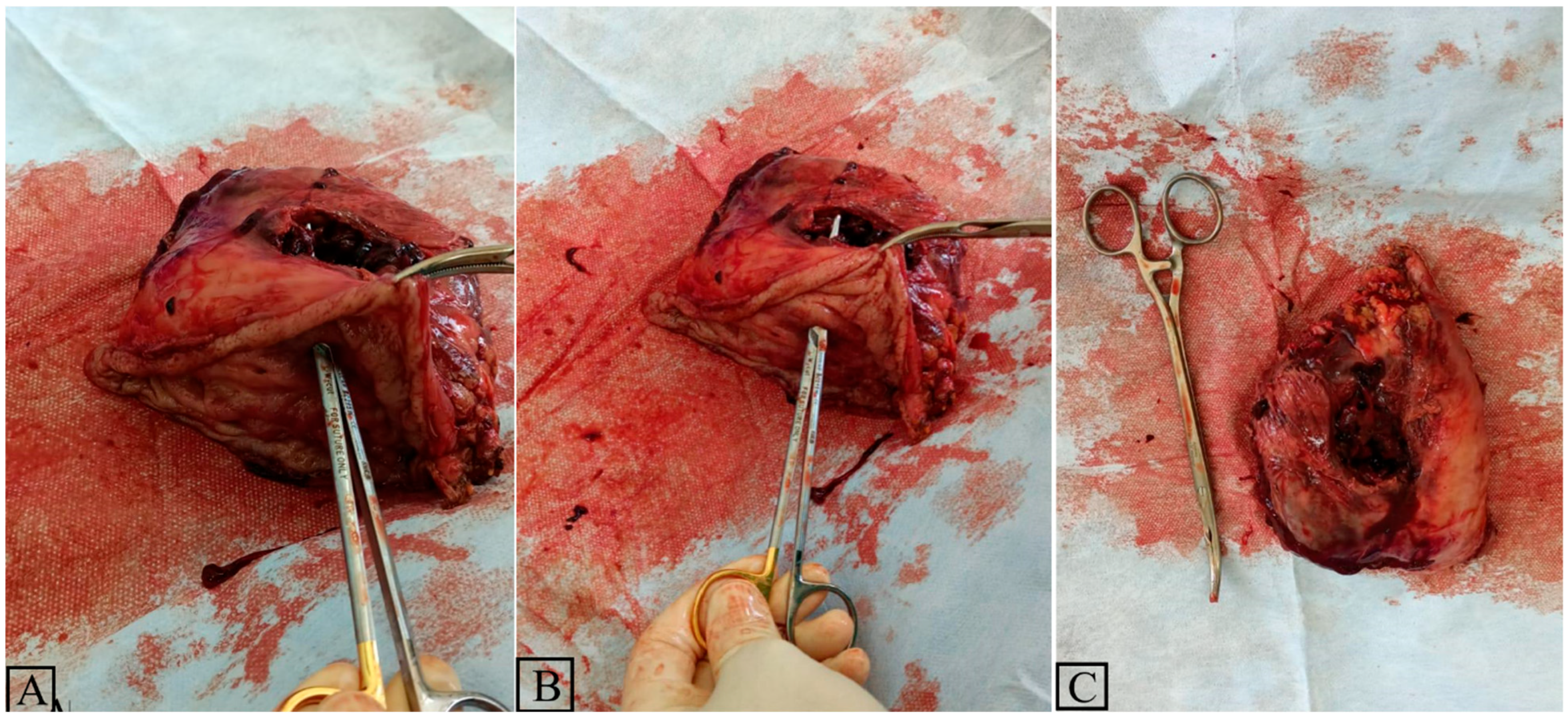 Diagnostics 15 00617 g003