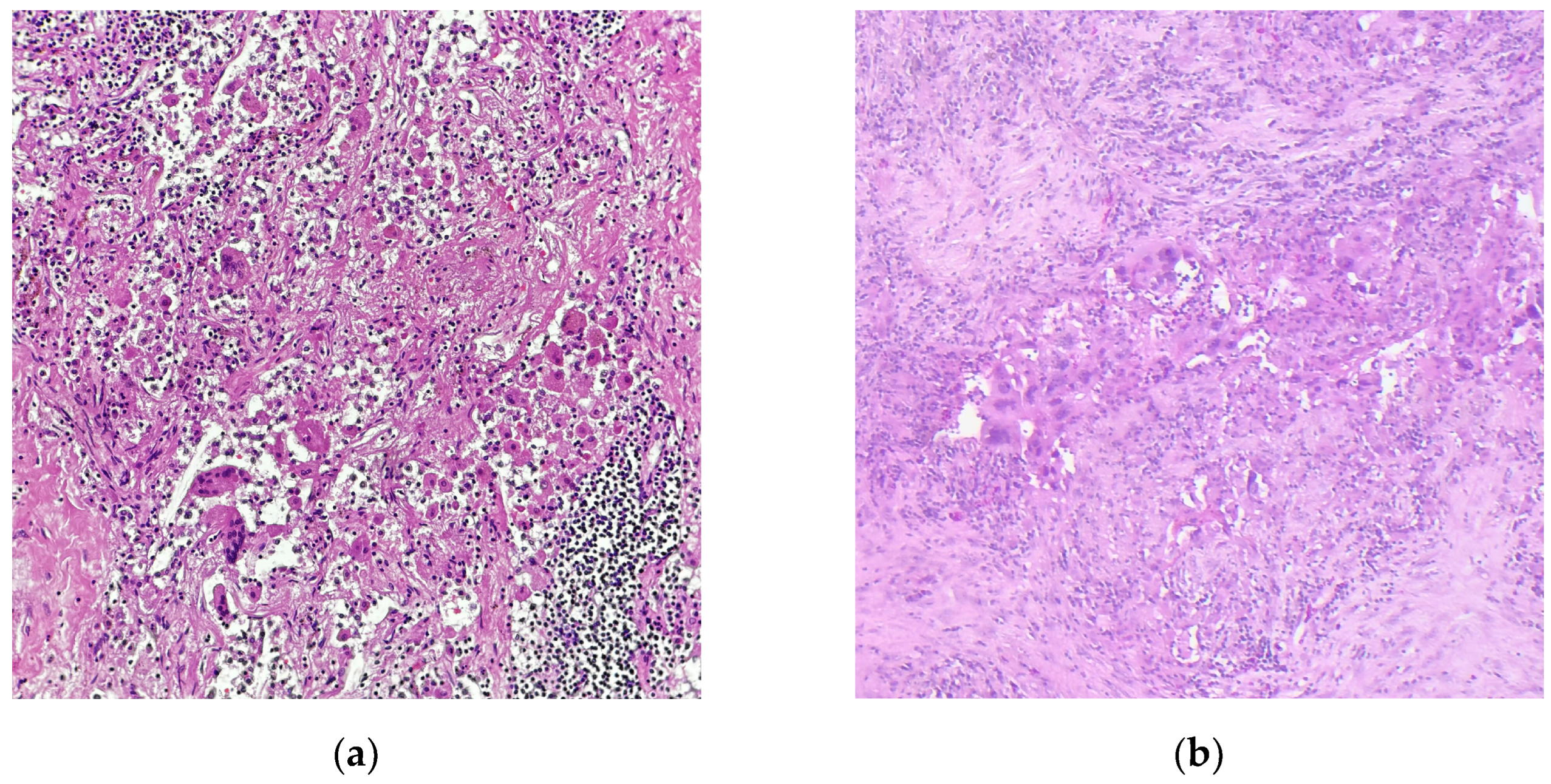 Diagnostics 15 00631 g001