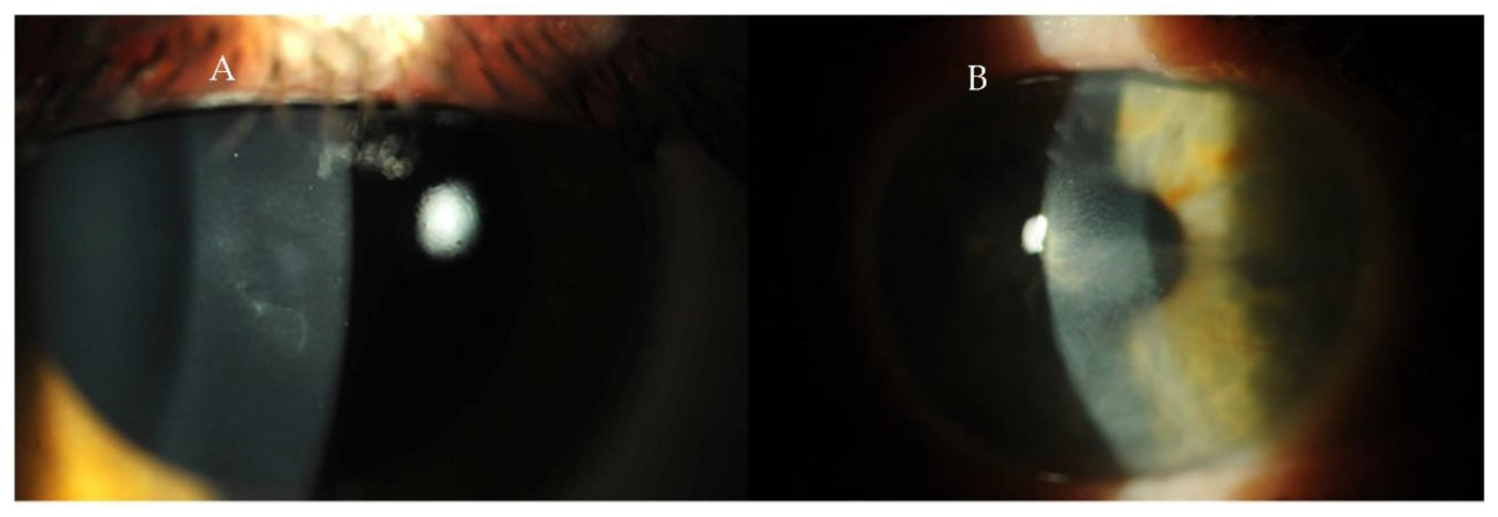 Diagnostics 15 00643 g003 Diagnostics 15 00643 g003