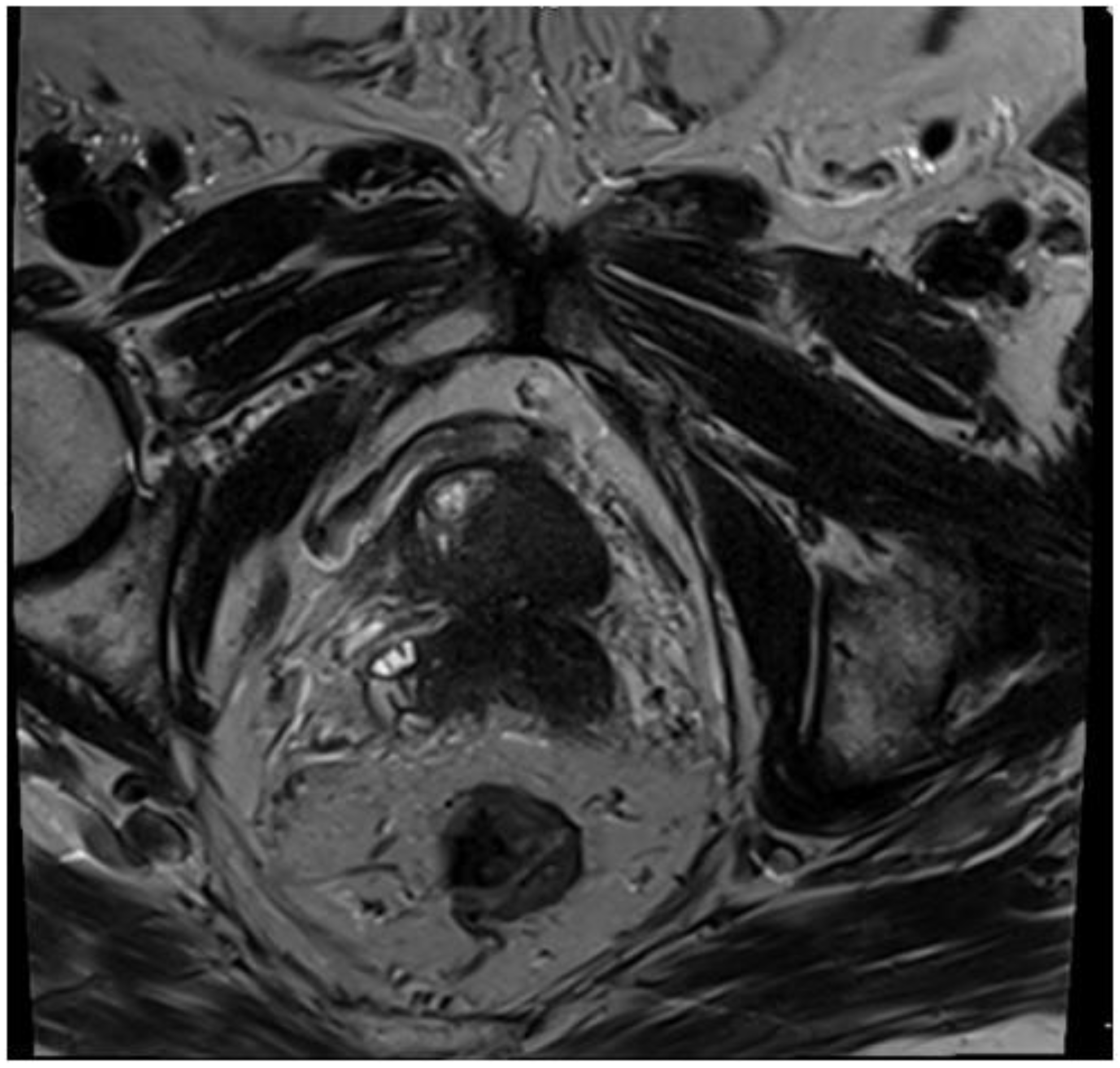 Diagnostics 15 00666 g005