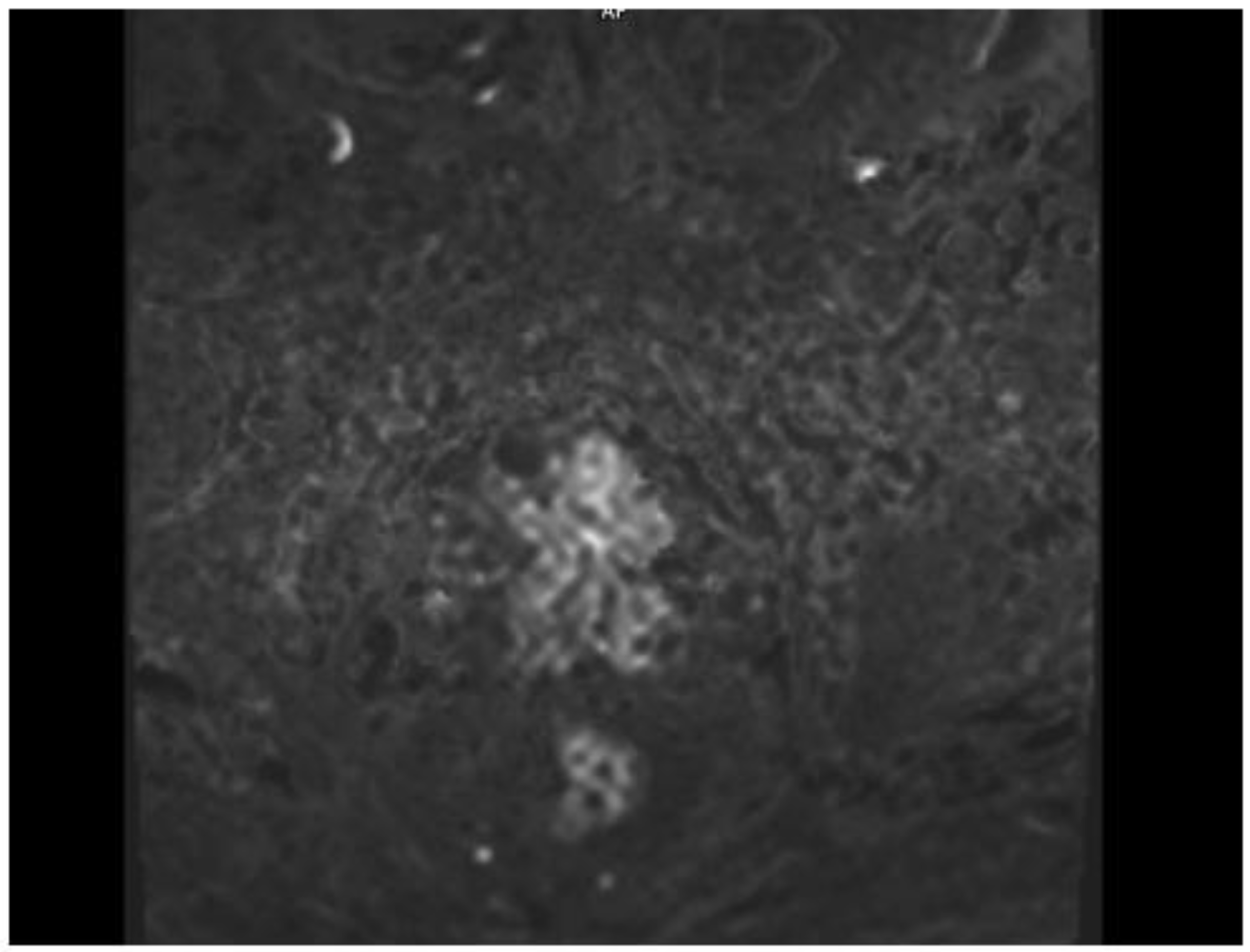 Diagnostics 15 00666 g006