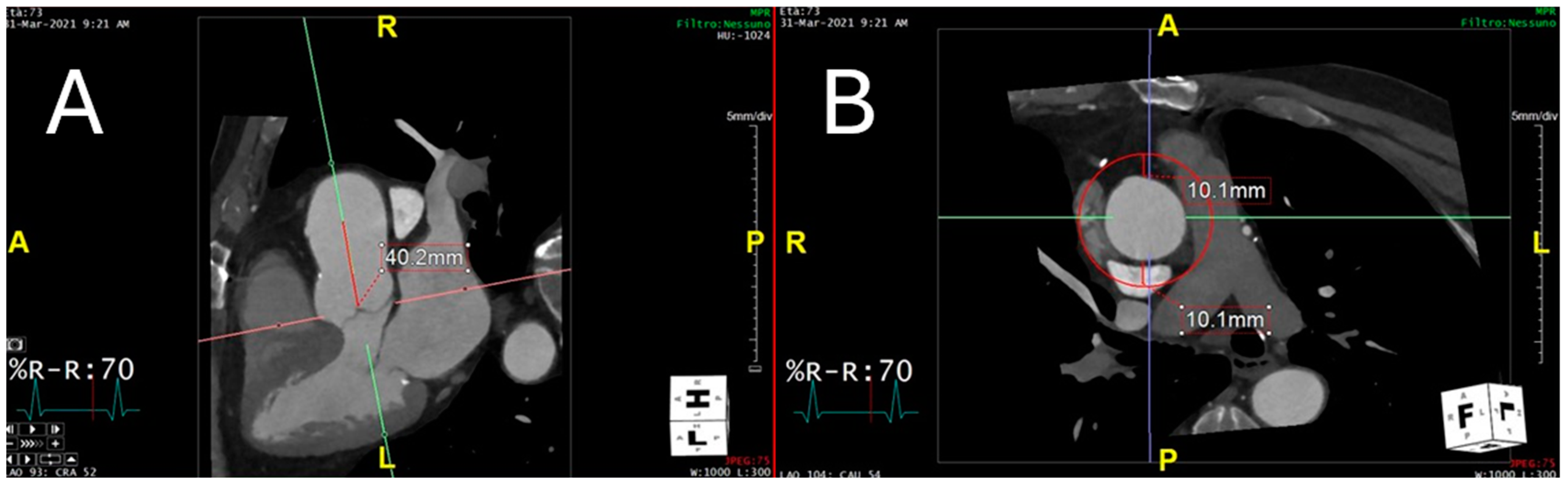 Diagnostics 15 00673 g002