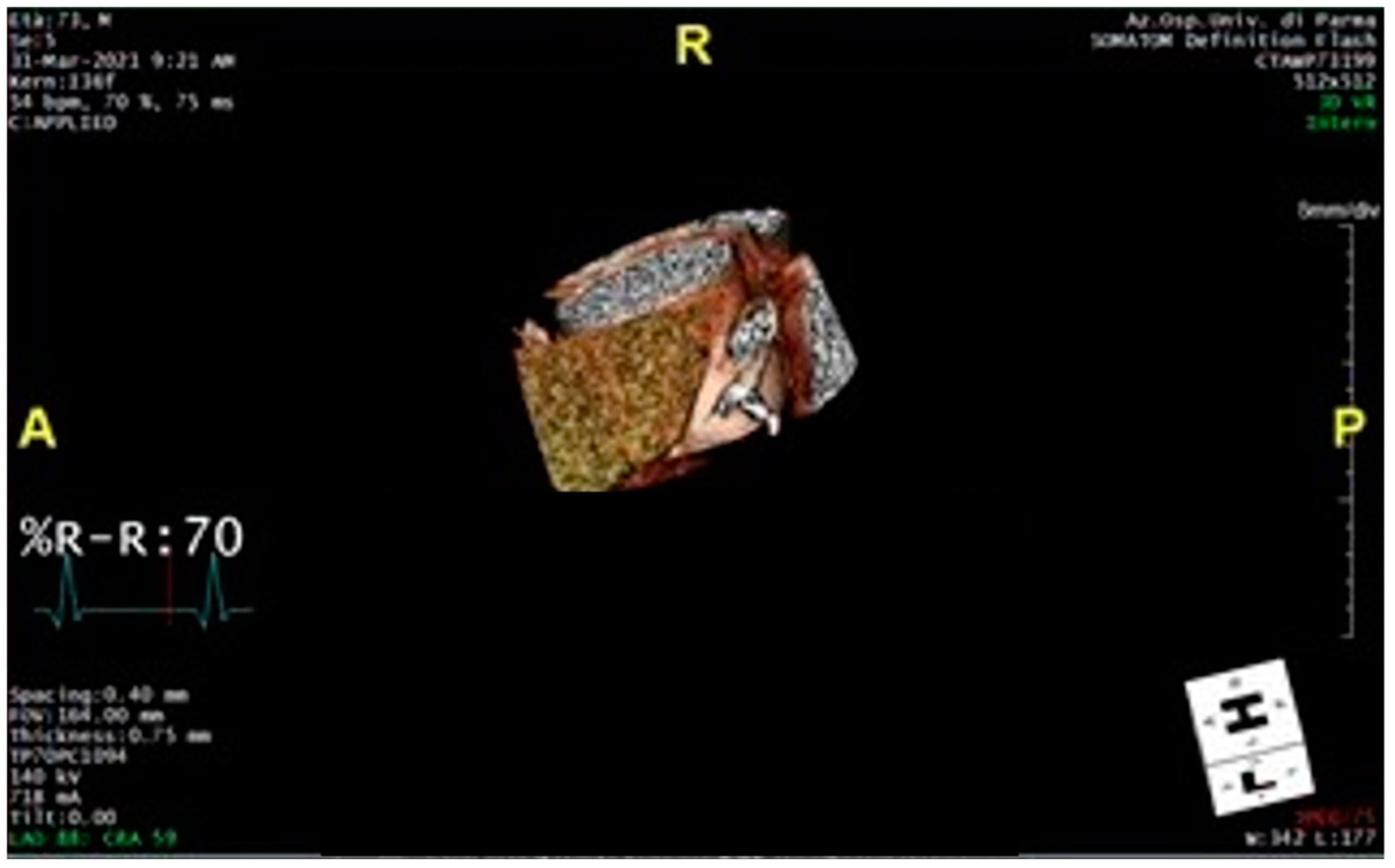 Diagnostics 15 00673 g004