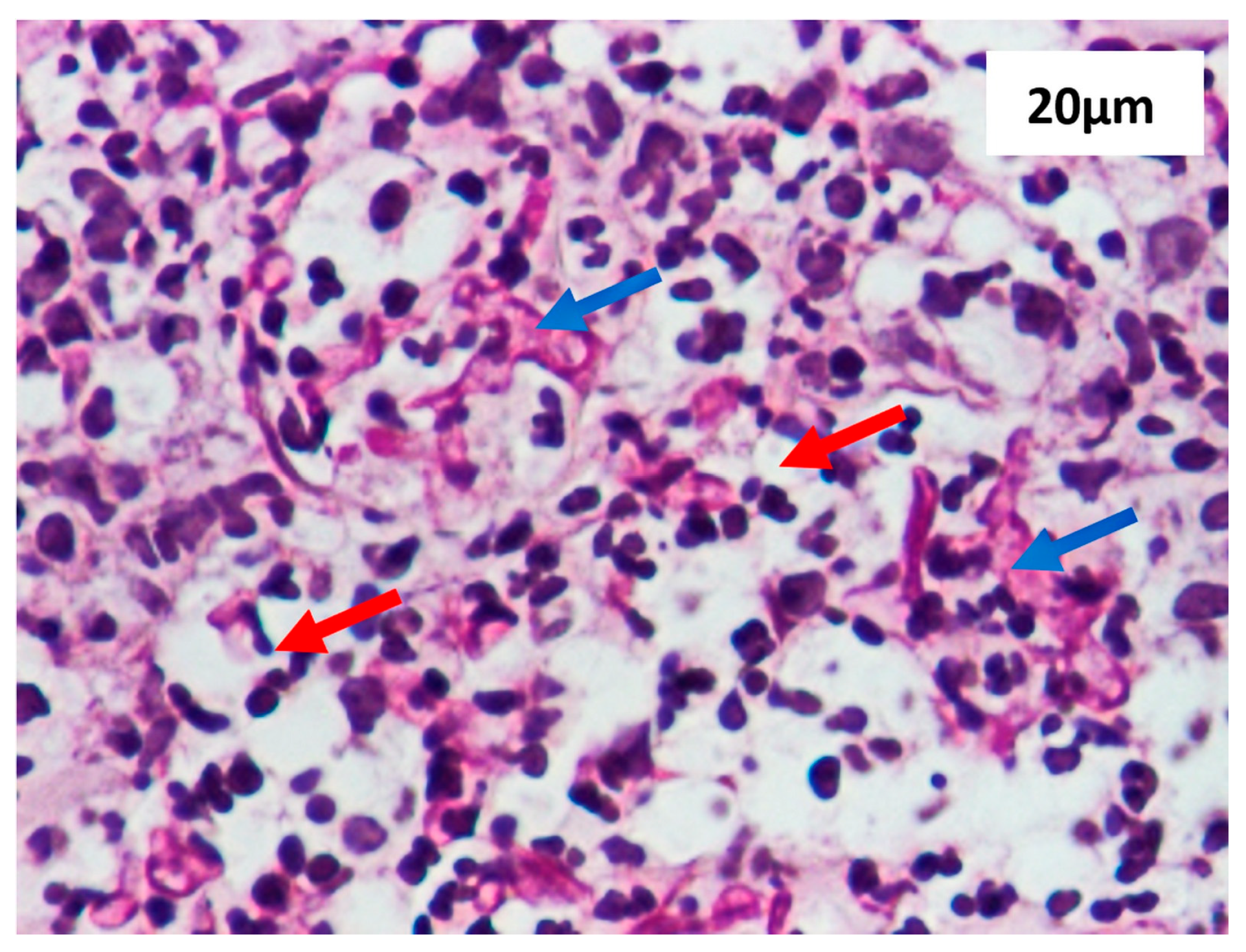 Diagnostics 15 00688 g004 Diagnostics 15 00688 g004