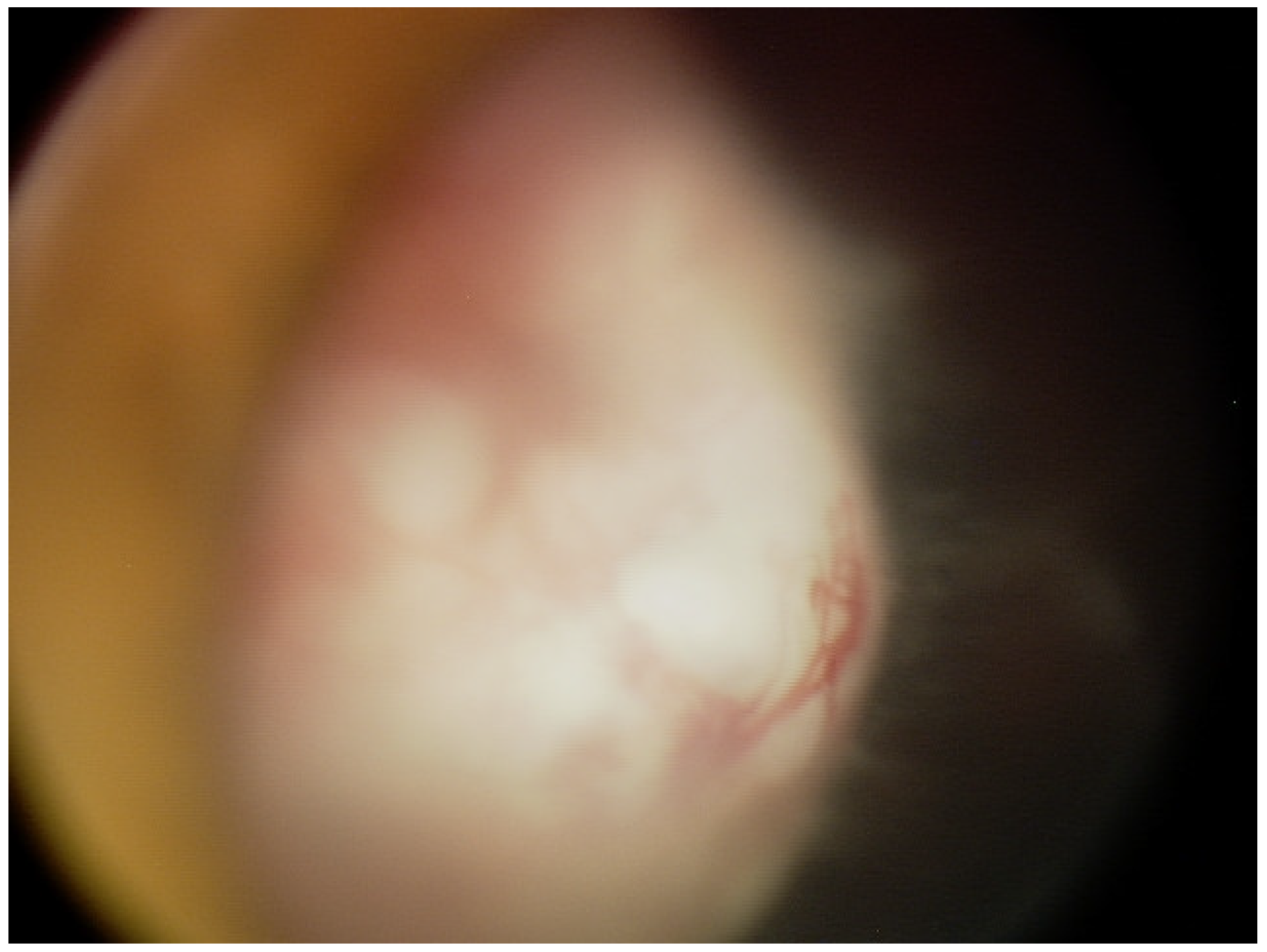 Diagnostics 15 00694 g001