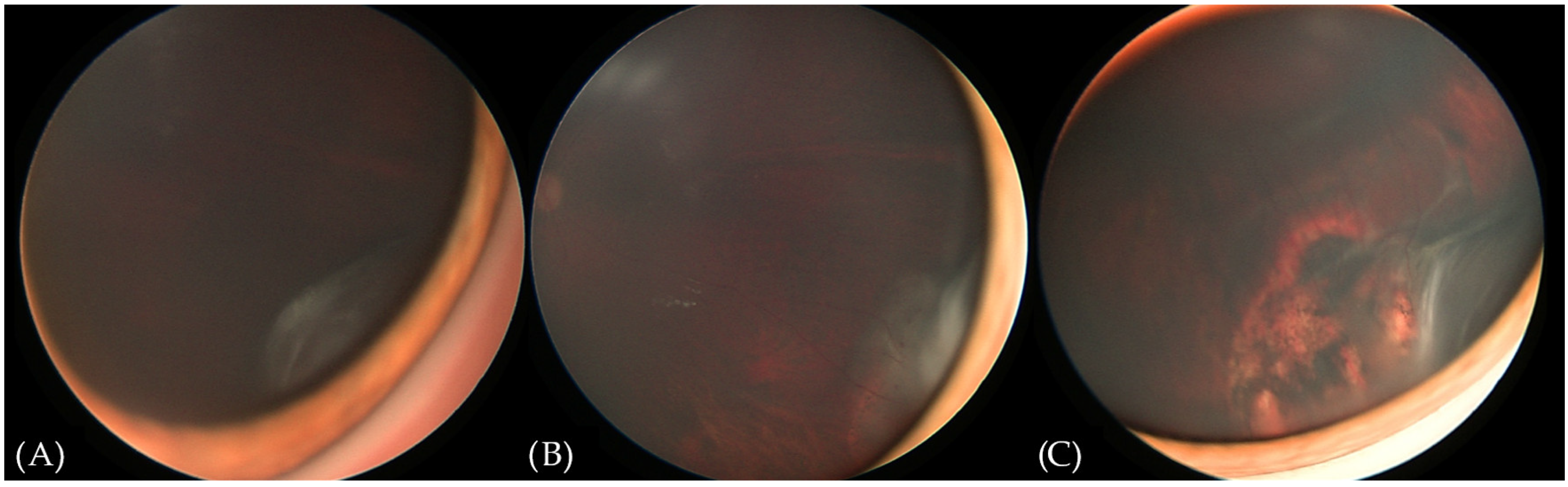 Diagnostics 15 00694 g003