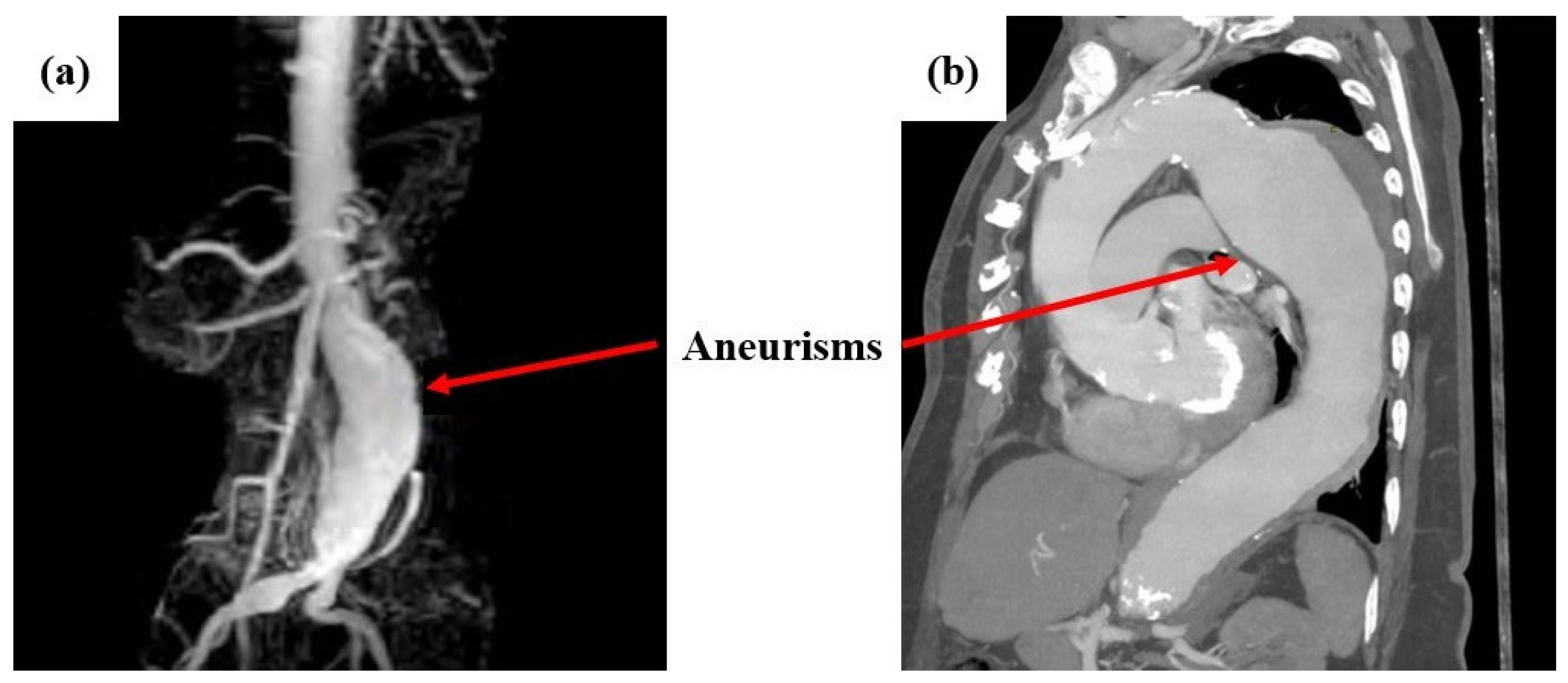 Diagnostics 15 00697 g001