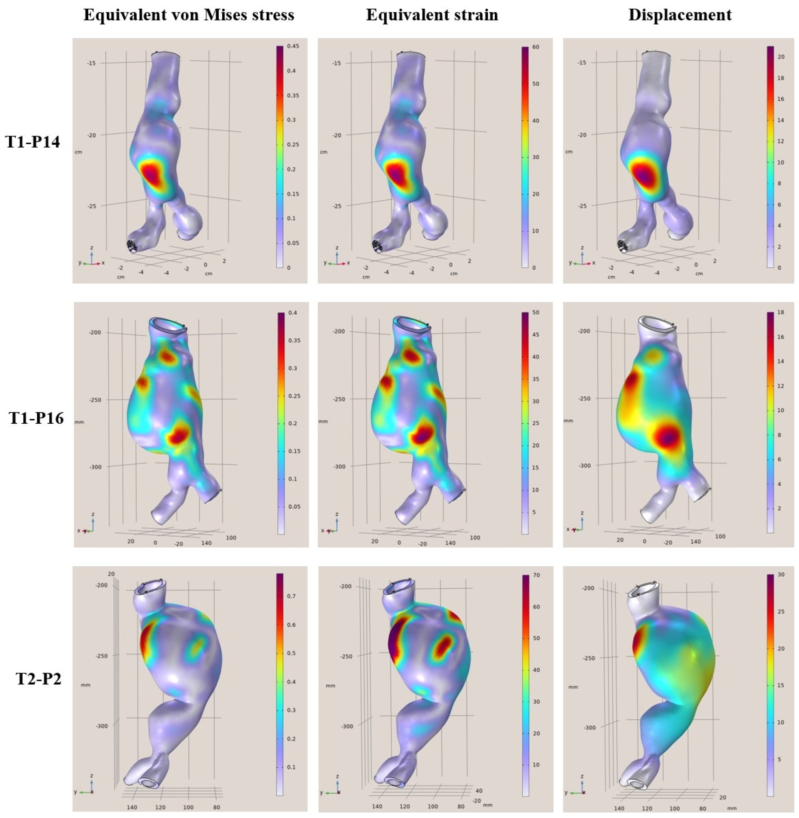 Diagnostics 15 00697 g006