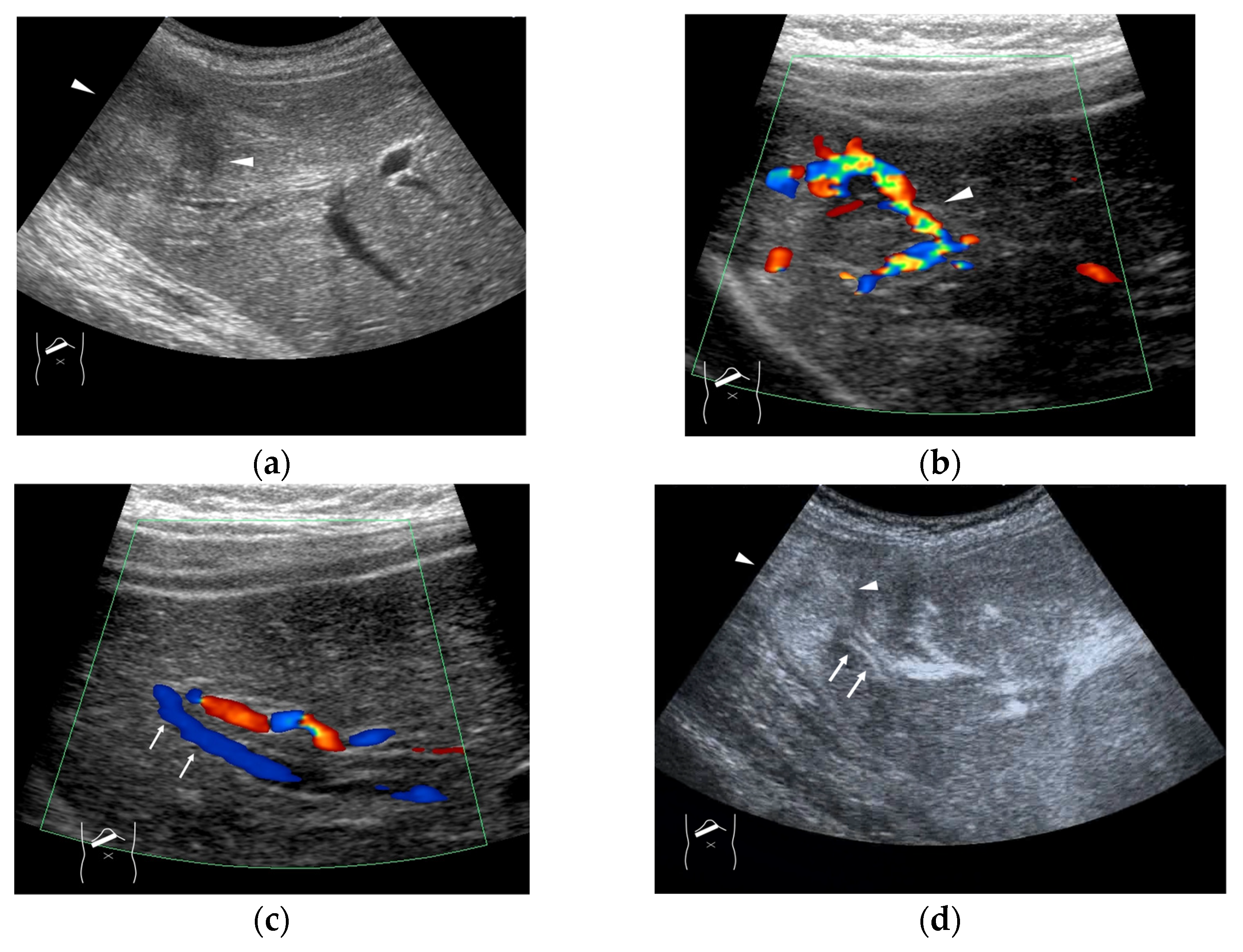 Diagnostics 15 00709 g004 Diagnostics 15 00709 g004