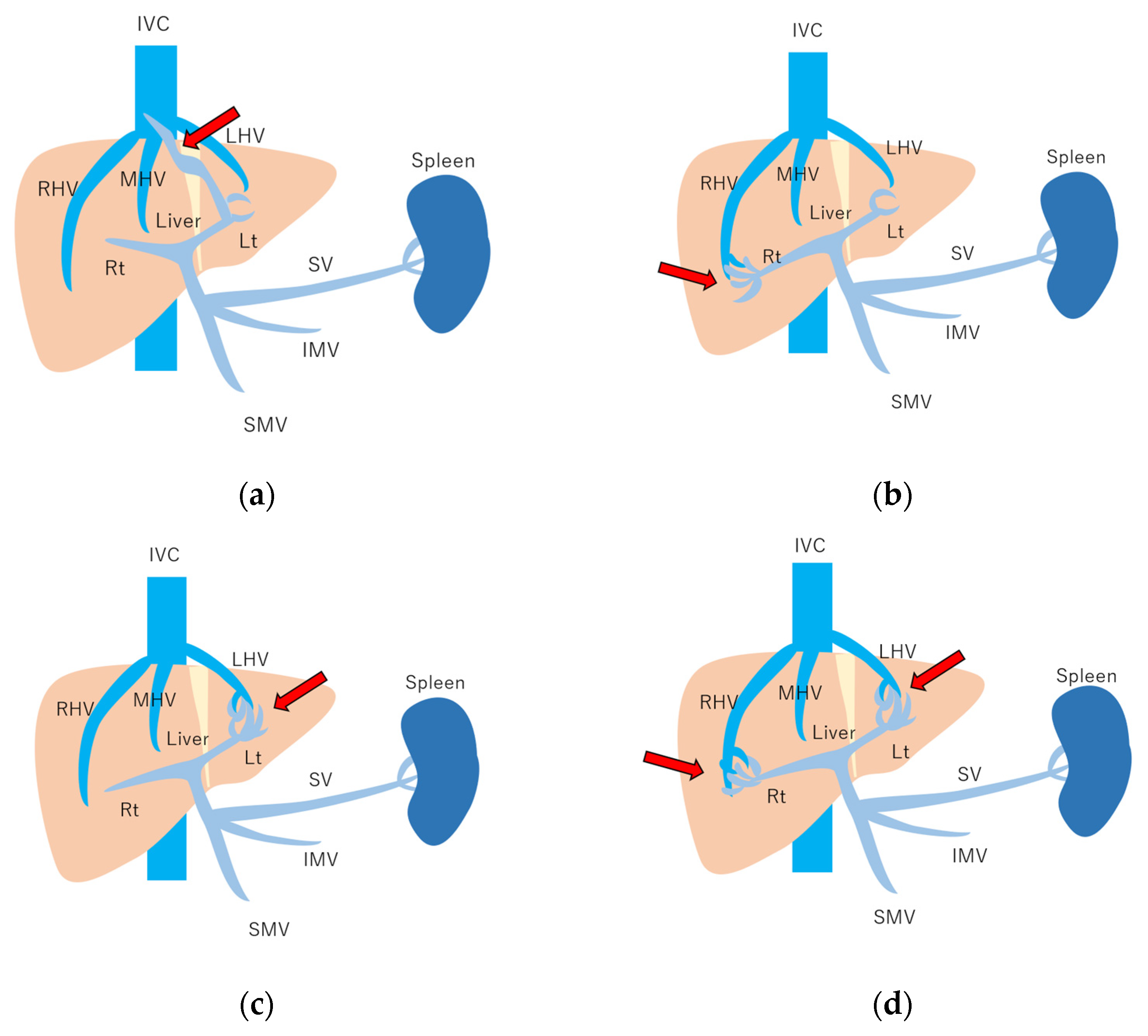 Diagnostics 15 00709 g010 Diagnostics 15 00709 g010
