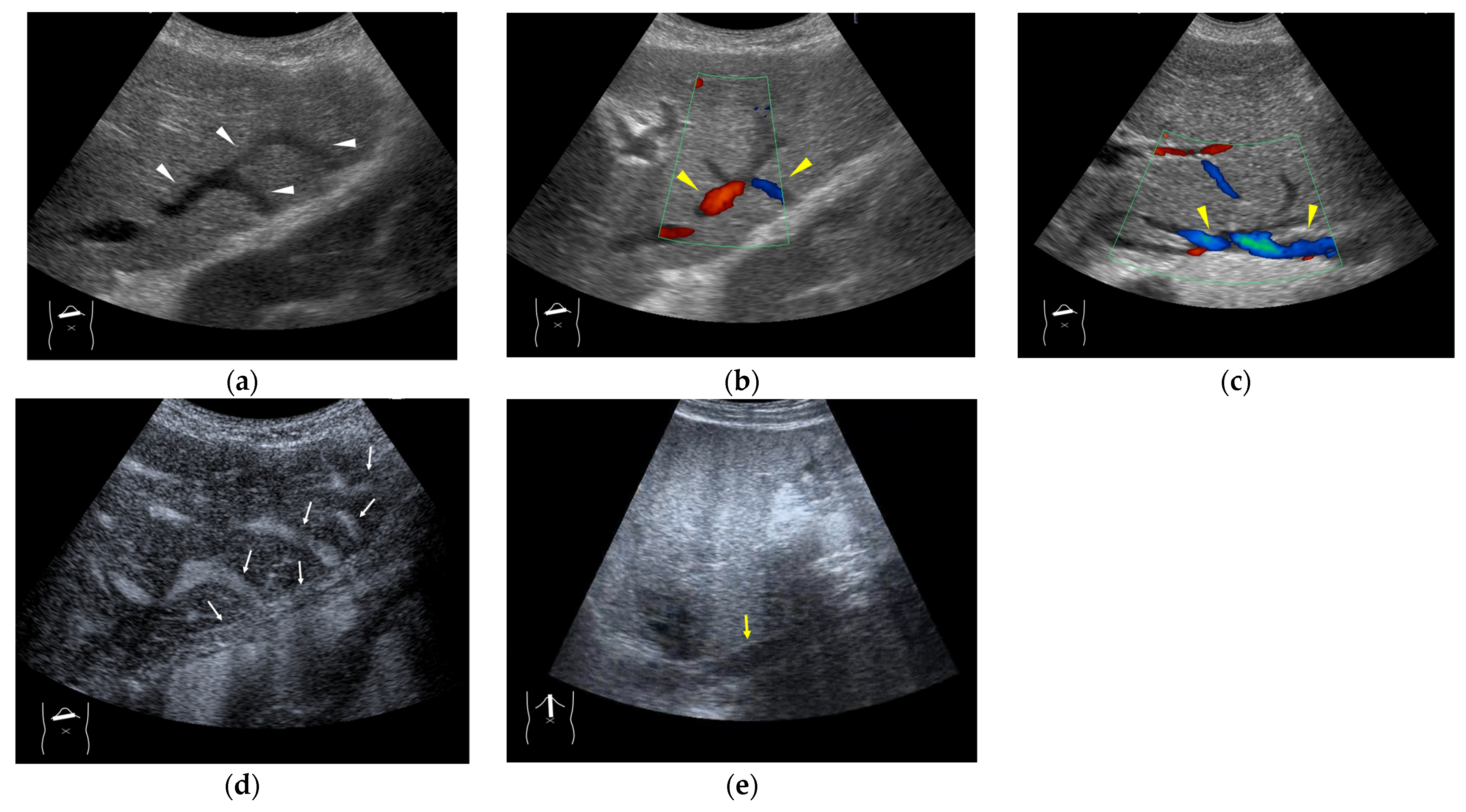 Diagnostics 15 00709 g013 Diagnostics 15 00709 g013