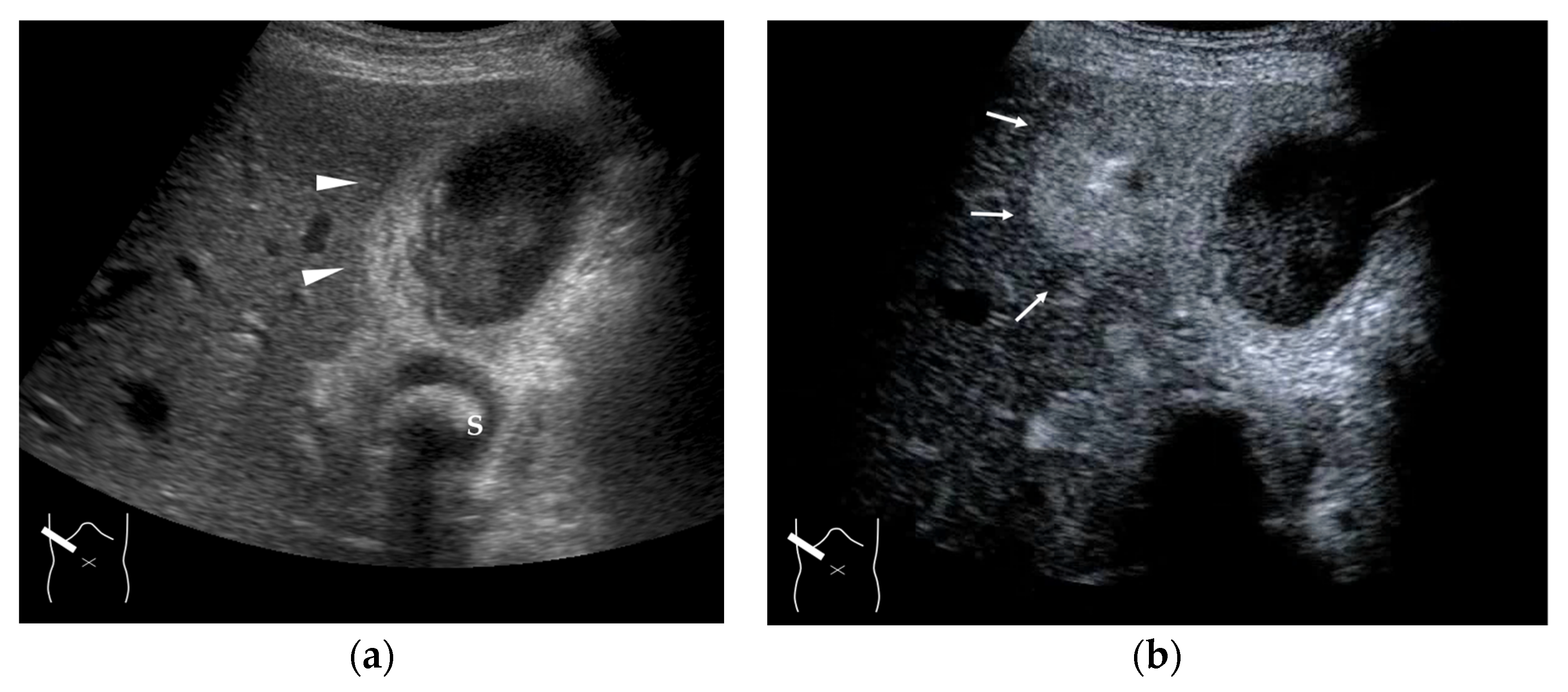 Diagnostics 15 00709 g015 Diagnostics 15 00709 g015