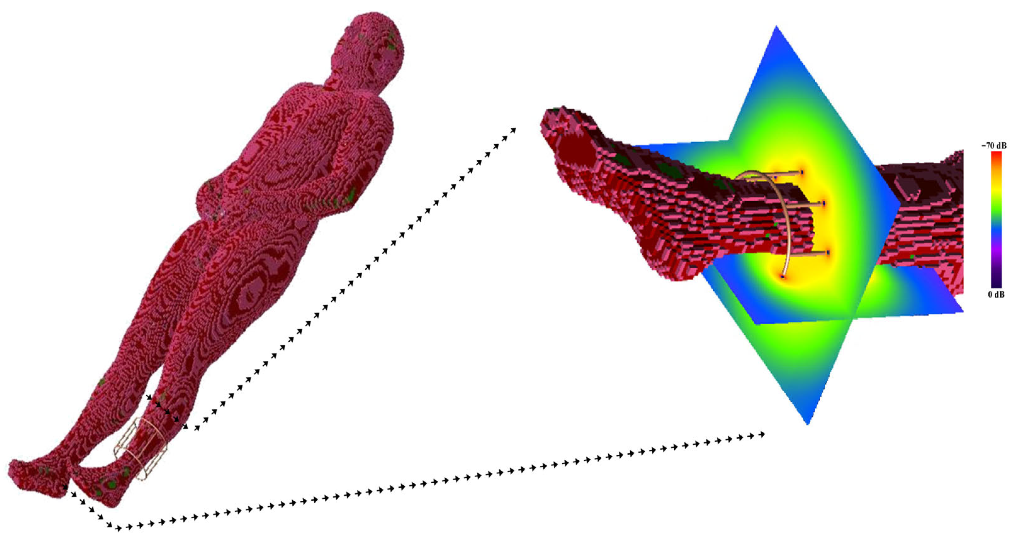 Diagnostics 15 00713 g006