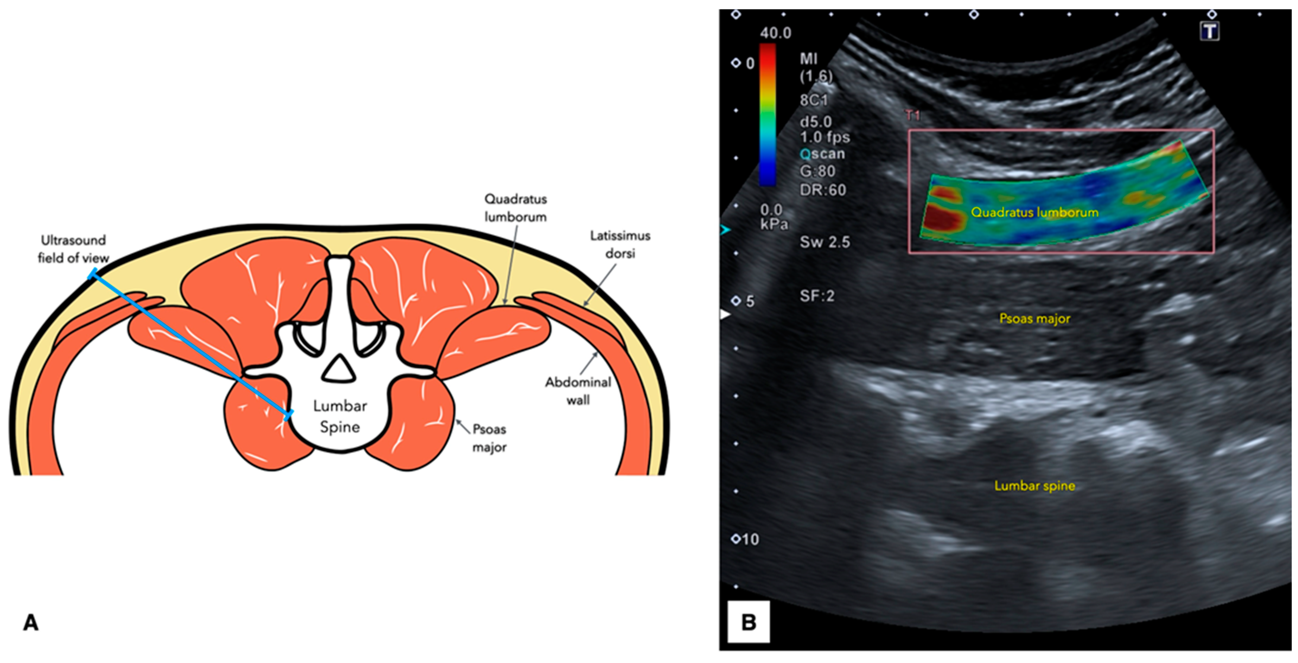 Diagnostics 15 00722 g002