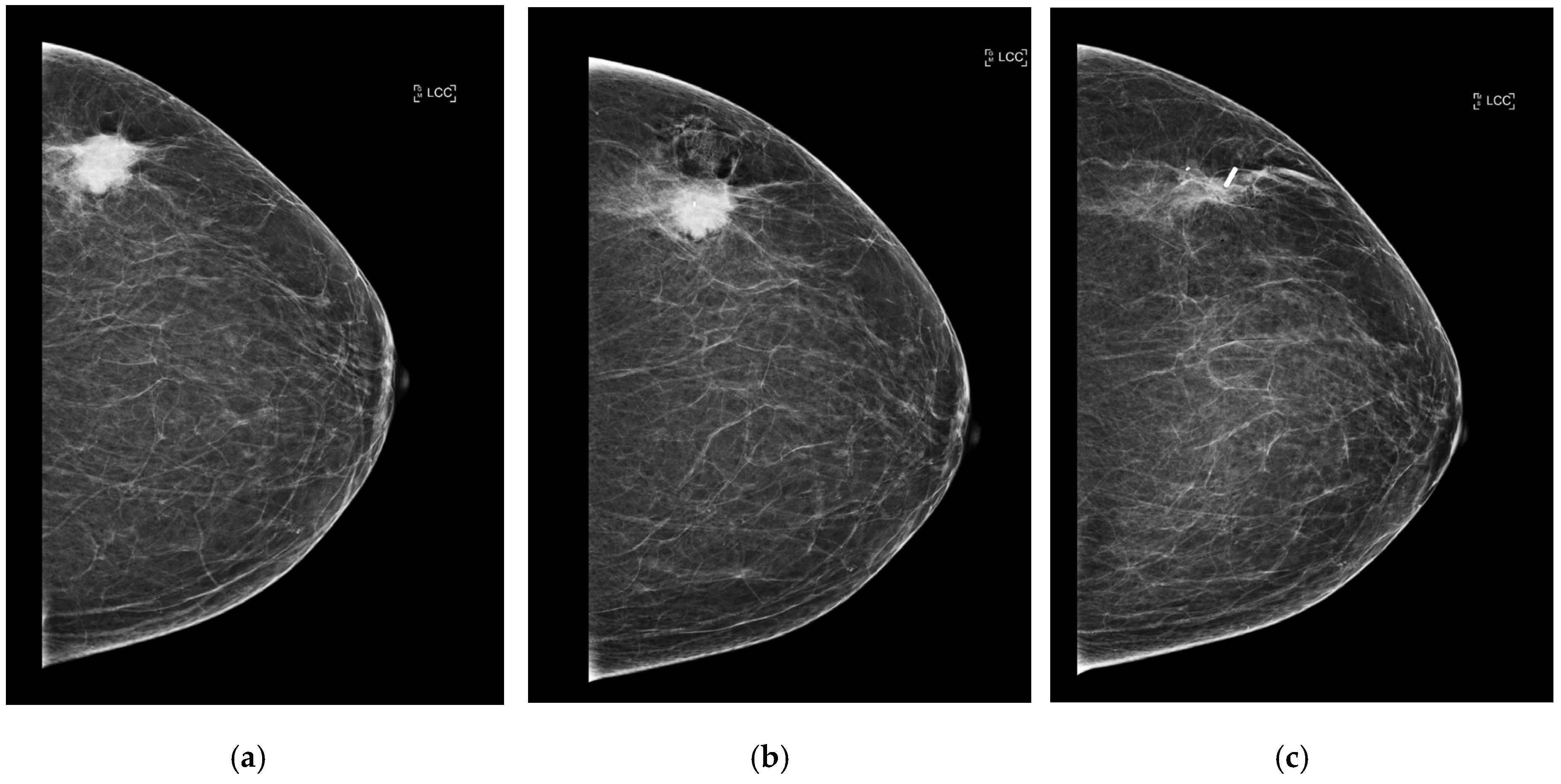 Diagnostics 15 00746 g003