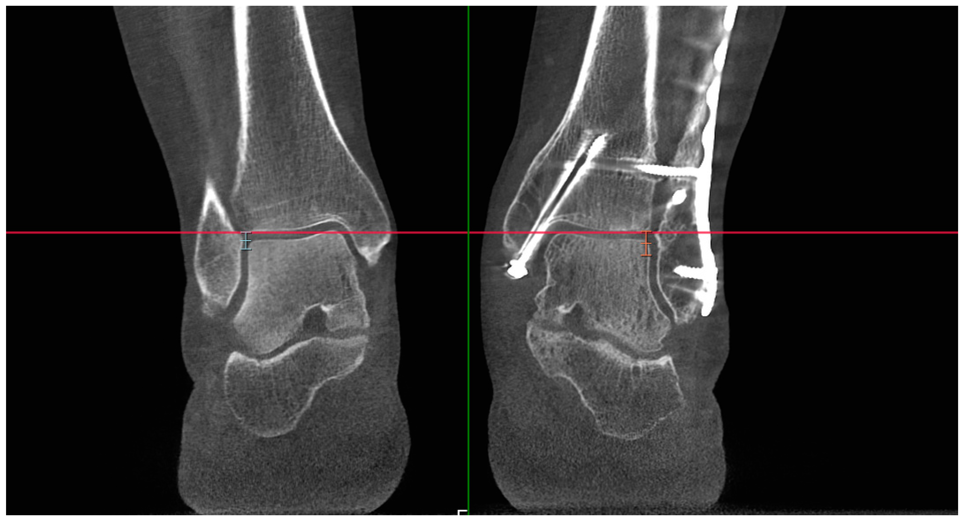 Diagnostics 15 00750 g001